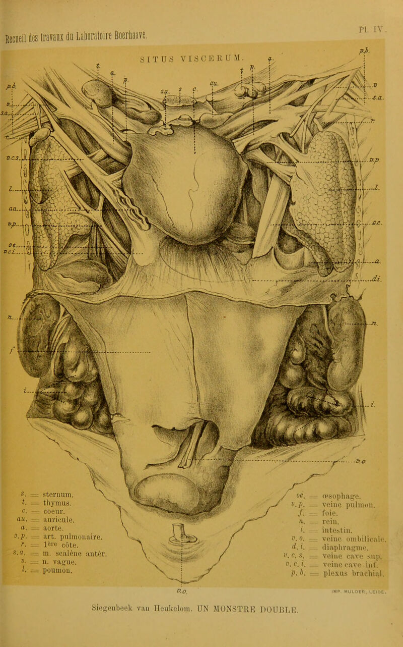 ri. iv tes S. — t. — c. — au. a. — ».P. = r. — s.a. — ü. — I. = sternum, thymus, coeur, auricule. aorte, art. pulmonaire. 1ère côte. m. scalène antêr. n. vague, poumon. ■vo œsophage. veine pulmon. foie. rein. intestin. veine omhilicale diaphragme, veine cave snp. veine cave inf. plexus brachial. ■sa. JSz.