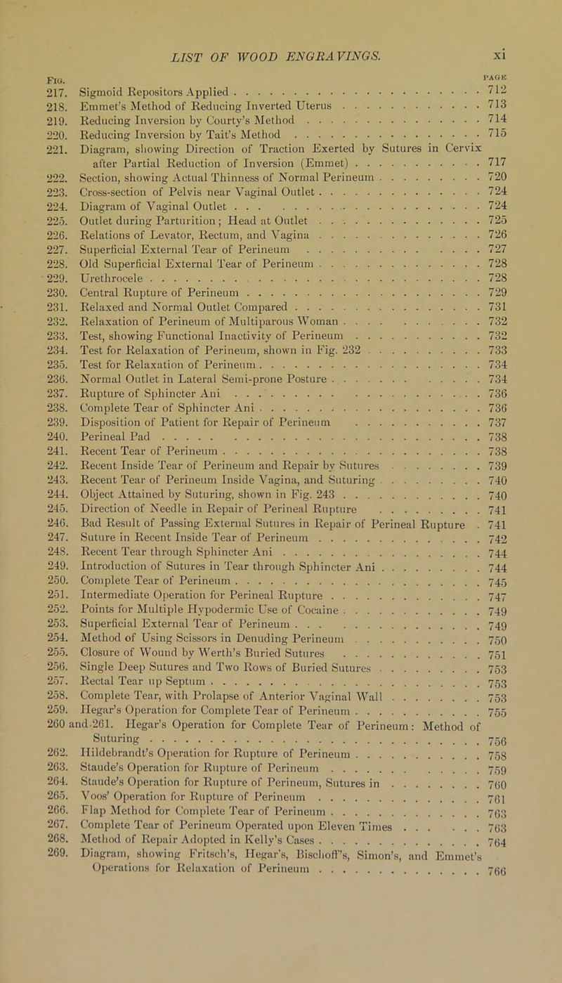 Fio. ™GB 217. Sigmoid Repositors Applied 712 218. Emmet’s Method of Reducing Inverted Uterus 713 219. Reducing Inversion by Courty’s Method 714 220. Reducing Inversion by Tait’s Method 715 221. Diagram, showing Direction of Traction Exerted by Sutures in Cervix after Partial Reduction of Inversion (Emmet) 717 222. Section, showing Actual Thinness of Normal Perineum 720 223. Cross-section of Pelvis near Vaginal Outlet 724 224. Diagram of Vaginal Outlet 724 225. Outlet during Parturition ; Head at Outlet 725 226. Relations of Levator, Rectum, and Vagina 726 227. Superficial External Tear of Perineum 727 228. Old Superficial External Tear of Perineum 728 229. Urethrocele 728 230. Central Rupture of Perineum 729 231. Relaxed and Normal Outlet Compared 731 232. Relaxation of Perineum of Multiparous Woman ... 732 233. Test, showing Functional Inactivity of Perineum 732 234. Test for Relaxation of Perineum, shown in Fig. 232 733 235. Test for Relaxation of Perineum 734 236. Normal Outlet in Lateral Semi-prone Posture 734 237. Rupture of Sphincter Ani 736 238. Complete Tear of Sphincter Ani 736 239. Disposition of Patient for Repair of Perineum 737 240. Perineal Pad 738 241. Recent Tear of Perineum 738 242. Recent Inside Tear of Perineum and Repair by Sutures 739 243. Recent Tear of Perineum Inside Vagina, and Suturing 740 244. Object Attained by Suturing, shown in Fig. 243 740 245. Direction of Needle in Repair of Perineal Rupture 741 246. Bad Residt of Passing External Sutures in Repair of Perineal Rupture . 741 247. Suture in Recent Inside Tear of Perineum 742 248. Recent Tear through Sphincter Ani 744 249. Introduction of Sutures in Tear through Sphincter Ani 744 250. Complete Tear of Perineum 745 251. Intermediate Operation for Perineal Rupture 747 252. Points for Multiple Hypodermic Use of Cocaine 749 253. Superficial External Tear of Perineum 749 254. Method of Using Scissors in Denuding Perineum 750 255. Closure of Wound by Werth’s Buried Sutures 751 256. Single Deep Sutures and Two Rows of Buried Sutures 753 257. Rectal Tear up Septum 753 258. Complete Tear, with Prolapse of Anterior Vaginal Wall 753 259. Hegar’s Operation for Complete Tear of Perineum 755 260 and-261. Flegar’s Operation for Complete Tear of Perineum: Method of Suturing • • - 262. Hildebrandt’s Operation for Rupture of Perineum 758 263. Staude’s Operation for Rupture of Perineum 759 264. Staude’s Operation for Rupture of Perineum, Sutures in 760 265. Voos’ Operation for Rupture of Perineum 761 266. Flap Method for Complete Tear of Perineum 763 267. Complete Tear of Perineum Operated upon Eleven Times 763 268. Method of Repair Adopted in Kelly’s Cases 764 269. Diagram, showing Fritsch’s, Hegar's, Bischoff’s, Simon’s, and Emmet’s Operations for Relaxation of Perineum 766