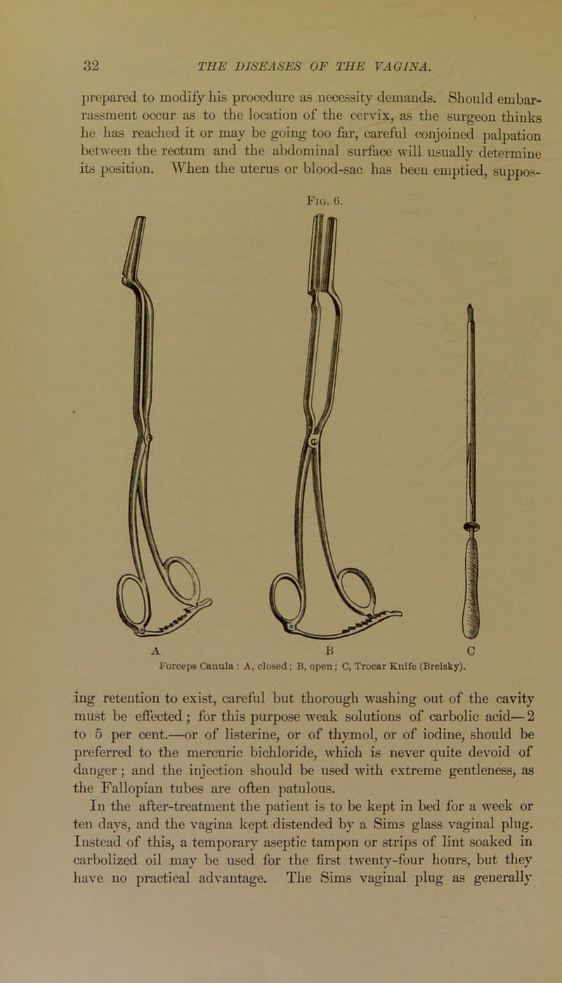 prepared to modify his procedure as necessity demands. Should embar- rassment occur as to the location of the cervix, as the surgeon thinks he has reached it or may be going too far, careful conjoined palpation between the rectum and the abdominal surface will usually determine its position. When the uterus or blood-sac has been emptied, suppos- Fig. 6. ing retention to exist, careful but thorough washing out of the cavity must be effected; for this purpose weak solutions of carbolic acid—2 to 5 per cent.—or of listerine, or of thymol, or of iodine, should be preferred to the mercuric bichloride, which is never quite devoid of danger; and the injection should be used with extreme gentleness, as the Fallopian tubes are often patulous. In the after-treatment the patient is to be kept in bed for a week or ten days, and the vagina kept distended by a Sims glass vaginal plug. Instead of this, a temporary aseptic tampon or strips of lint soaked in carbolized oil may be used for the first twenty-four hours, but they have no practical advantage. The Sims vaginal plug as generally