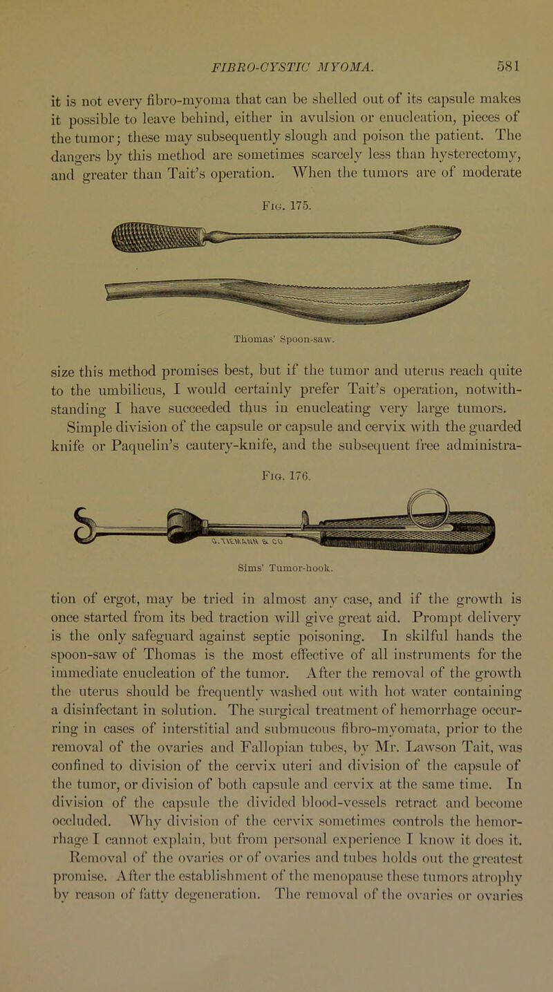 it is not every fibro-myoma that can be shelled out of its capsule makes it possible to leave behind, either in avulsion or enucleation, pieces of the tumor; these may subsequently slough and poison the patient. The dangers by this method are sometimes scarcely less than hysterectomy, and greater than Tait’s operation. When the tumors are of moderate Fig. 175. Thomas' Spoon-saw. size this method promises best, but if the tumor and uterus reach quite to the umbilicus, I would certainly prefer Tait’s operation, notwith- standing I have succeeded thus in enucleating very large tumors. Simple division of the capsule or capsule and cervix with the guarded knife or Paquelin’s cautery-knife, and the subsequent free administra- Fig. 17 6. Sims' Tumor-hook. tion of ergot, may be tried in almost any case, and if the growth is once started from its bed traction will give great aid. Prompt delivery is the only safeguard against septic poisoning. In skilful hands the spoon-saw of Thomas is the most effective of all instruments for the immediate enucleation of the tumor. After the removal of the growth the uterus should be frequently washed out with hot water containing a disinfectant in solution. The surgical treatment of hemorrhage occur- ring in cases of interstitial and submucous fibro-myomata, prior to the removal of the ovaries and Fallopian tubes, by Mr. Lawson Tait, was confined to division of the cervix uteri and division of the capsule of the tumor, or division of both capsule and cervix at the same time. In division of the capsule the divided blood-vessels retract and become occluded. Why division of the cervix sometimes controls the hemor- rhage I cannot explain, but from personal experience I know it does it. Removal of the ovaries or of ovaries and tubes holds out the greatest promise. A fter the establishment of the menopause these tumors atrophy by reason of fatty degeneration. The removal of the ovaries or ovaries