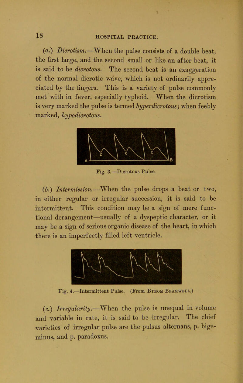 (a.) Dicrotism.—When the pulse consists of a double beat, the first large, and the second small or like an after beat, it is said to be dicrotous. The second beat is an exaggeration of the normal dicrotic wave, which is not ordinarily appre- ciated by the fingers. This is a variety of pulse commonly met with in fever, especially typhoid. When the dicrotism is very marked the pulse is termed hyperdicrotous; when feebly marked, hypodicrotous. Fig. 3.—Dicrotous Pulse. (h.') Intermission.—When the pulse drops a beat or two, in either regular or irregular succession, it is said to be intermittent. This condition may be a sign of mere func- tional derangement—usually of a dyspeptic character, or it may be a sign of serious organic disease of the heart, in which there is an imperfectly filled left ventricle. Fig. 4.—Intermittent Pulse. (From Btbom Bbamwell.) (c.) Irregularity.—When the pulse is unequal in volume and variable in rate, it is said to be irregular. The chief varieties of irregular pulse are the pulsus alternans, p. bige- minus, and p. paradoxus.