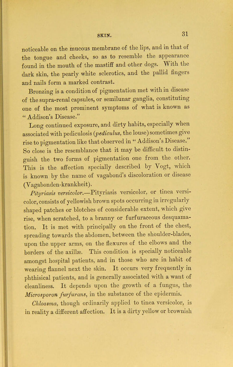 noticeable on the mucous membrane of the lips, and in that of the tongue and cheeks, so as to resemble the appearance found in the mouth of the mastiff and other dogs. With the dark skin, the pearly white sclerotics, and the pallid fingers and nails form a marked contrast. Bronzing is a condition of pigmentation met with in disease of the supra-renal capsules, or semilunar ganglia, constituting one of the most prominent symptoms of what is known as “ Addison’s Disease.” Long continued exposure, and dirty habits, especially when associated with pediculosis {pediculus, the louse) sometimes give rise to pigmentation like that observed in “ Addison s Disease. So close is the resemblance that it may be difficult to distin- guish the two forms of pigmentation one from the other. This is the affection specially described by Vogt, which is known by the name of vagabond s discoloration or disease (V agabonden-krankheit). Pityriasis versicolor.—Pityriasis versicolor, or tinea versi- color, consists of yellowish brown spots occurring in irregularly shaped patches or blotches of considerable extent, which give rise, when scratched, to a branny or furfuraceous desquama- tion. It is met with principally on the front of the chest, spreading towards the abdomen, between the shoulder-blades, upon the upper arms, on the flexures of the elbows and the borders of the axillse. This condition is specially noticeable amongst hospital patients, and in those who are in habit of wearing flannel next the skin. It occurs very frequently in phthisical patients, and is generally associated with a want of cleanliness. It depends upon the growth of a fungus, the Microsporon furfurans, in the substance of the epidermis. Chloasma, though ordinarily applied to tinea versicolor, is in reality a different affection. It is a dirty yellow or brownish