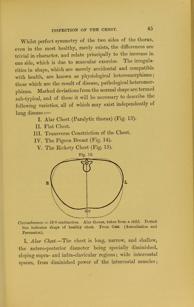 Whilst perfect symmetry of the two sides of the thorax, even in the most, healthy, rarely exists, the differences are trivial in character, and relate principally to the increase in one side, which is due to muscular exercise. The irregula- rities in shape, which are merely accidental and compatible with health, are known as physiological heteromorphisms; those which are the result of disease, pathological heteromor- phisms. Marked deviations from the normal shape are termed sub-typical, and of these it will be necessary to describe the following varieties, all of which may exist independently of lung disease:— I. Alar Chest (Paralytic thorax) (Fig. 13). II. Flat Chest. III. Transverse Constriction of the Chest. IV. The Pigeon Breast (Fig. 14). V. The Kickety Chest (Fig. 15). Fig. 13. Circumference = 59'0 centimetres. Alar thorax, taken from a child. Dotted line indicates shape of healthy chest. From Gbe. (Auscultation and Percussion). I. Alar Chest—The chest is long, narrow, and shallow, the antero-posterior diameter being specially diminished, sloping supra- and infra-clavicular regions; wide intercostal spaces, from diminished power of the intercostal muscles;