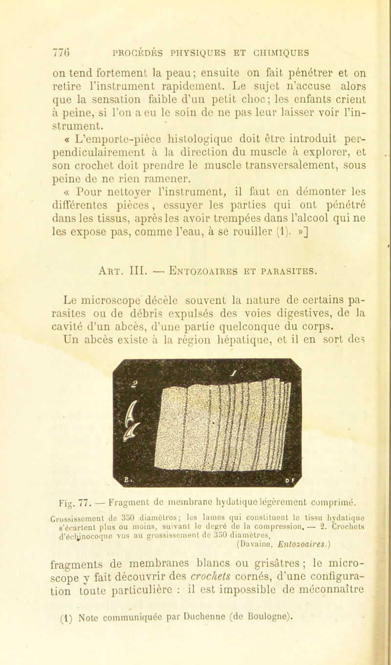 on tend fortement la peau; ensuile on fait penetrer et on retire I’instrament rapidement. Le siijet n’accuse alors que la sensation faible d’un petit choc; les enfants crient a peine, si Ton a eu le soin de ne pas leur laisser voir I’in- strninent. <5 L’emporte-piece hisLologiquc doit etre iatroduit per- pendiculairement a la direction du muscle a explorer, et son crochet doit prendre le muscle transversalement, sous peine de ne rien ramener. « Pour netloyer I’instrument, il faut en demonter les difl’^rentes pieces, essuyer les parties qui onl pen^tre dans les tissus, apres les avoir tremp^es dans I’alcool qui ne les expose pas, comme Peau, a se rouiller (1). »] Art. III. — Entozoaires et parasites. Le microscope ddcele souvenl la nature de certains pa- rasites ou de debris expuls^s des voies digestives, de la cavitd d’un abces, d’une partie quelconque du corps. Un abces existe a la region hepatique, et il en sort des Fig. 77. — Fragment de ineinbrano liydutique legerement comprime. Gi'ossissement de 350 diametros; lea lames <]ui conslUuont le lissu liydatiquo s’dcartenl plus ou moins, suivaiU lo de^rd do la compression.— 2. Crochets d'dclynocoque vua au grossissement de 330 diamhtros. {Davaino, Eiitoxoaires.) fragments de membranes blancs ou grisatres; le micro- scope y fait decouvrir des crochets corn^s, d’une configura- tion toute particuliere : il est impossible de meconnaitre (1) Note communiqude par Duchenne (de Boulogne).