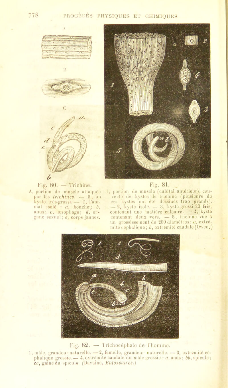 I’UOCKlU^o I'lIVSIQVES ET CHlMigUKS / / s I'iiz. 80. — Tricitine. HI. A. |Mirliun ilc muscle uUiu|ueu 1, purliun do muscle {ciibilul luiLoriour), cou- par Ics trichines. — 11, uu \oi'lo do kyslos do tiiciiiiie (plusiours do k\'.lo Ires-j'i-ossi. — 0, I’ani- rj-, ky^slos out die dossiuos Irop grands', iiiai Isold : a, l)0uclic; h, —2, kysLe isole. — 3, kysto {^russi 20 anus; c, losopl.af^o; d, or- coiitoiiaiil unc maliero culcairo. — 4, kyslc ^aiio soMicl : g, corps jaunes. conlunanl deux vors. — 5, tricliiuo vuc a un ■'rossissomont do 200 diameLros : oxlro- mile cupiialitpie ; b, oxti-dmild caudalo (Owen.) Fi^. 8:2. — Ti'ichocepliale do I'hoinnu’. 1, male, j^raiidcur naturclle. — 2, fomollo, ^M’aiuieur nalurcllc. — 3, c.\li «mitd ee- pliuliquc rossio. — 4. oxlremitd caudale du malo yi ossic • o, aims ; bb, sjiiculo ; CC, ;:alnedu >piciil«. (Uavainc, KntOiOiUf cs.)
