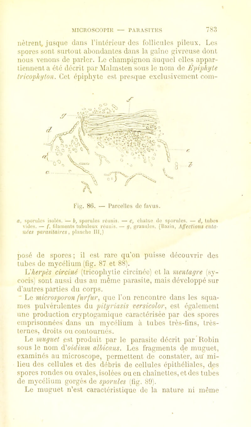 MICROSCOPIR PARASITKS 78?, iietrent, jusque dans rinlerieur dcs follicules pileux. Los spores sonl surtout abondaiiLcs dans la gainc givrcuse donl nous venons de parlor. Le champignon auqucl dies appar- tiennenla etc decril par Malmslen sotis le nom de Epiphyte Iricophyton. Cel epiphyte esL presque exclusivemcnt com- Fi. 80. — I'arcellos clc faviis. a, Jiporulcs isoU^s. — h, sporulos reunis. — c, cliaino do sporulcs. — d, lul)os vidos. — /*. lilamonts lubuleax reunls. — Q, granules. (Bazin, Affections cutci- nees f)arasitaivcs ^ planclic III.) posd de spores; il csl rare qu’on puisse ddcouvrir des tuhes de mycelium (fig. 87 et 88). L'herpes circine (tricophytie circinec) el la menlayre (.sy- cocis) sonl aussi dus an memo parasite, mais doveloppd sur d’autres parties du corps. ' Le microsporon furfur, que Ton rencontre dans les squa- mes pulvernlentes du pityriasis versicolor, est dgalemcnt une production cryptogamiipie caraetdrisee par dcs spores omprisonnees dans un myedlium a tnhes Ires-fins, tres- lernes, droits on conlournds. Le muguet psl produil par le parasite ddcrit par Hohin sous le nom (\'oidium albicans. Les I'raginents de muguet, exatninds au microscope, permetlent de constater, au' mi- lieu des cellules et des debris de cellules dpithdlialos, des spores rondcs on ovalcs, isolees ou en chainettes, et dcs lubes de mycdlium gorges de sporules (fig. 89). Le muguet n’esl caracldrisliquo do la nature ni meme