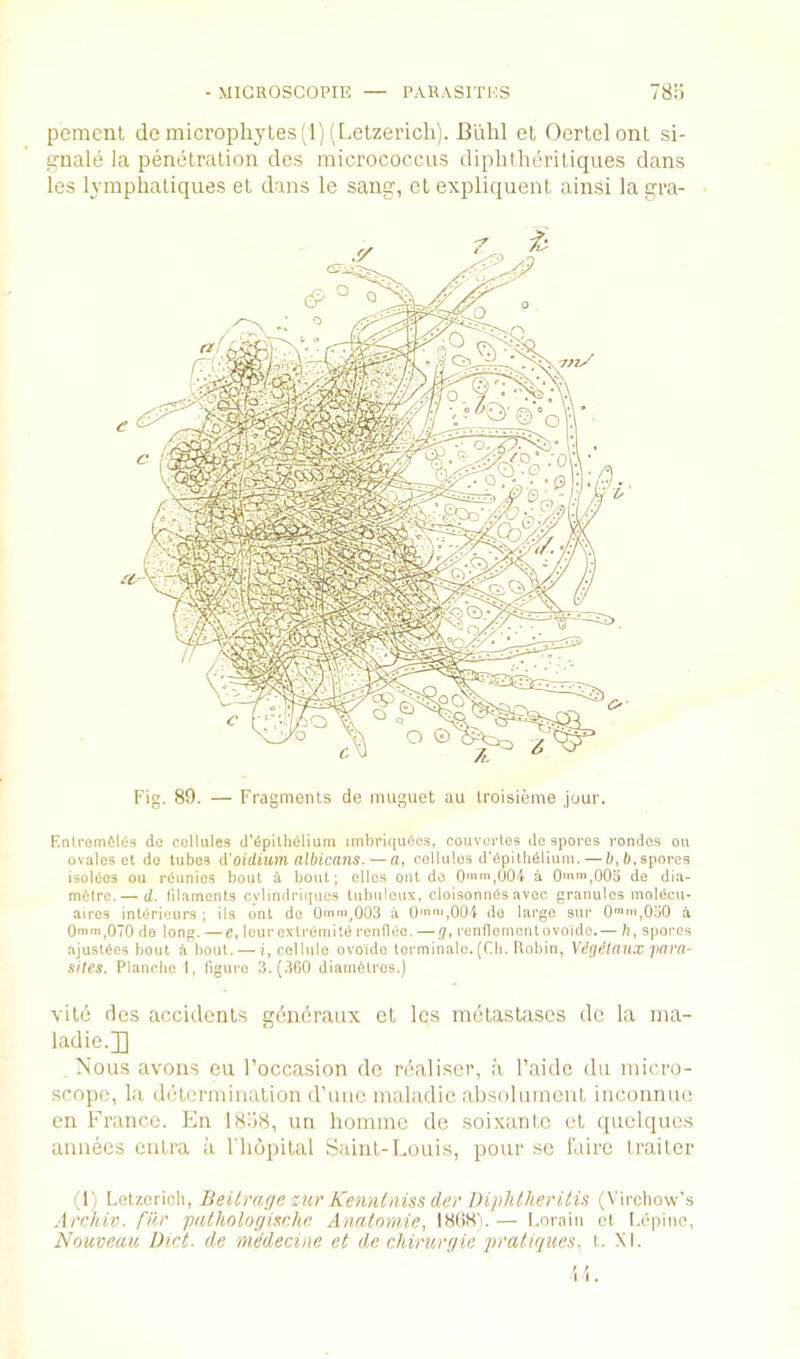 - MIGROSCOPIE — PARASITES 78K. peraenl dc microphytes (1) (Letzericli). Blihl et Oertel ont si- gnals la penetration des micrococcus diphtheritiques dans les lymphaliques et dans le sang, et expliquent ainsi la gra- Fig. 89. — Fragments de mugiiet au troisieme jour. F.niromfilfis do cellules d’6pith(ilium imbriqudes, coiivciTes de spores rondos on ovules et do lubes d'oidium albicans. — a, cellules d'6pithdliuni. — 6, 6,spores isoldcs ou rdunies bout i bout; dies ont de 0i',004 a Om'iqOOD de diu- mttro.— d. filaments cylindriques tubuloux, cloisonnds avec granules moldcu- airos intdrieurs ; ils ont do O'n'iqOOS a 0'«nij004 de large sur a 0mm,070 do long. — e, lour extremity renflce. — (J, renfloment ovoide.— b, spores ajuslSes bout A bout.— i, cellule ovo'i'do lorminalo. (Ch. Robin, Vdgdiaux para- sites. Planclic 1, figure 3. (.160 diarn6tros.) vite des accidents gdndraux et les metaslascs de la ma- ladie.]] Nous avons eu I’occasion de rdaliser, it I’aide du micro- scope, la determination d'niio maladic absolumeiit inconnue cn Franco. Fhi 18o8, un honimc de soixanl.o et quelques annees cutra it I'hopital Saint-Louis, pour se i'dire traitor (1) Letzericli, Beitmge zur Kenntniss der Diphtheritis (Virchow’s Archiv. filr pathnlogischa Anatomic, 18(iH). — Lorain el I.epiiic, Nouveau Diet, de niddecine et de chiruryie pratiques, t. XI.