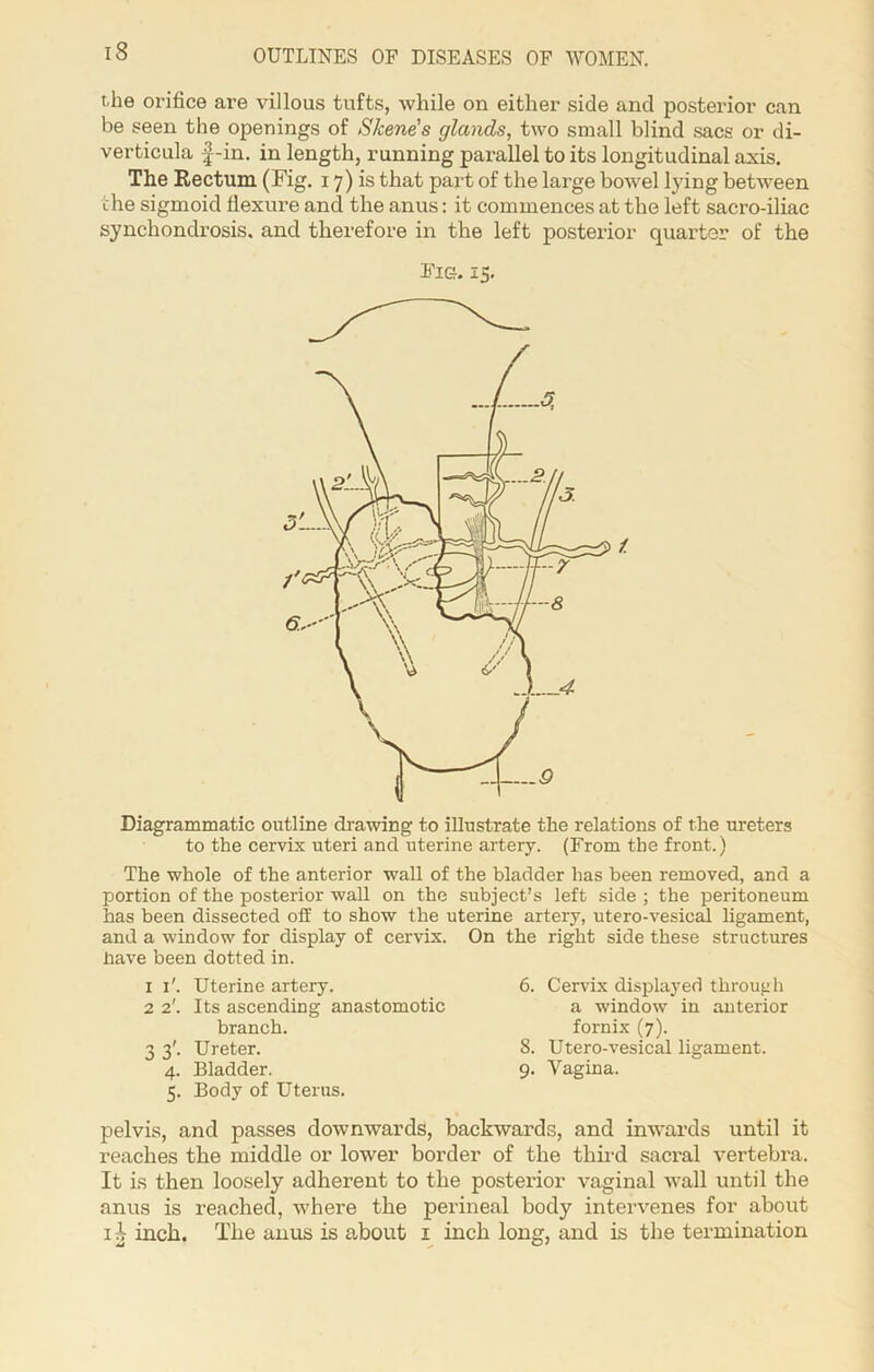 t.he orifice are villous tufts, while on either side and posterior can be seen the openings of Skene's glands, two small blind sacs or di- verticula f-in. in length, running parallel to its longitudinal axis. The Rectum (Fig. 17) is that part of the large bowel lying between the sigmoid flexure and the anus: it commences at the left sacro-iliac synchondrosis, and therefore in the left posterior quarter of the Fie. 15. t 8 Diagrammatic outline drawing to illustrate the relations of the ureters to the cervix uteri and uterine artery. (From the front.) The whole of the anterior wall of the bladder has been removed, and a portion of the posterior wall on the subject’s left side ; the peritoneum has been dissected off to show the uterine artery, utero-vesical ligament, and a window for display of cervix. On the right side these structures nave been dotted in. 1 1'. Uterine artery. 2 2'. Its ascending anastomotic branch. 3 3'. Ureter. 4. Bladder. 5. Body of Uterus. pelvis, and passes downwards, backwards, and inwards until it reaches the middle or lower border of the third sacral vertebra. It is then loosely adherent to the posterior vaginal wall until the anus is reached, where the perineal body intervenes for about i-i inch. The anus is about 1 inch long, and is the termination 6. Cervix displayed through a window in anterior fornix (7). 8. Utero-vesical ligament. 9. Vagina.