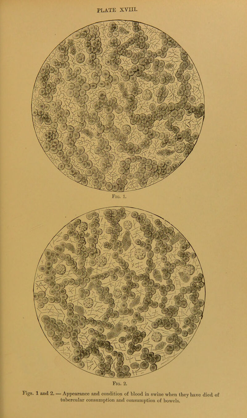 Fig. 1. Fig. 2. Figs. 1 and 2. — Appearance and condition of blood in swine when they have died of tubercular consumption and consumption of bowels.