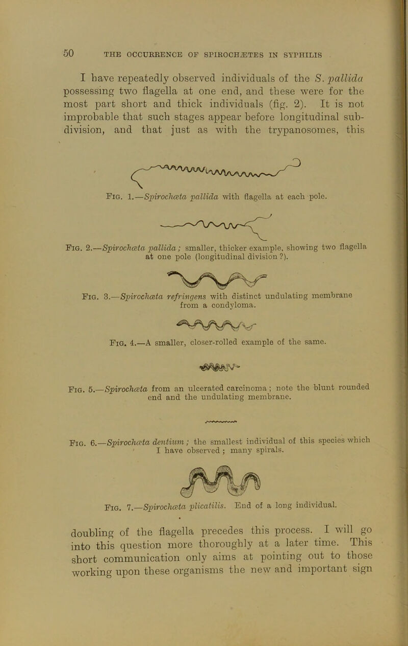 I have repeatedly observed individuals of the 8. x>cillida possessing two flagella at one end, and these were for the most part short and thick individuals (fig. 2). It is not improbable that such stages appear before longitudinal sub- division, and that just as with the trypanosomes, this Fig. 2.—Spirochata pallida; smaller, thicker example, showing two flagella at one pole (longitudinal division ?). Fig. 3.—Spirochceta refrivgens with distinct undulating membrane from a condyloma. Fig. 5.—Spirochceta from an ulcerated carcinoma; note the blunt rounded end and the undulating membrane. Fig. 6.—Spirochceta dentiwn; the smallest individual of this species which ' I have observed ; many spirals. doubling of the flagella precedes this process. ^ I will go into this question more thoroughly at a later time. This short communication only aims at pointing out to those working upon these organisms the new and important sign Fig. 1.—Spirochceta pallida with flagella at each pole. Fig. 4.—a smaller, closer-rolled example of the same. Fig. 7.—Spirochceta plicatilis. End of a long individual.