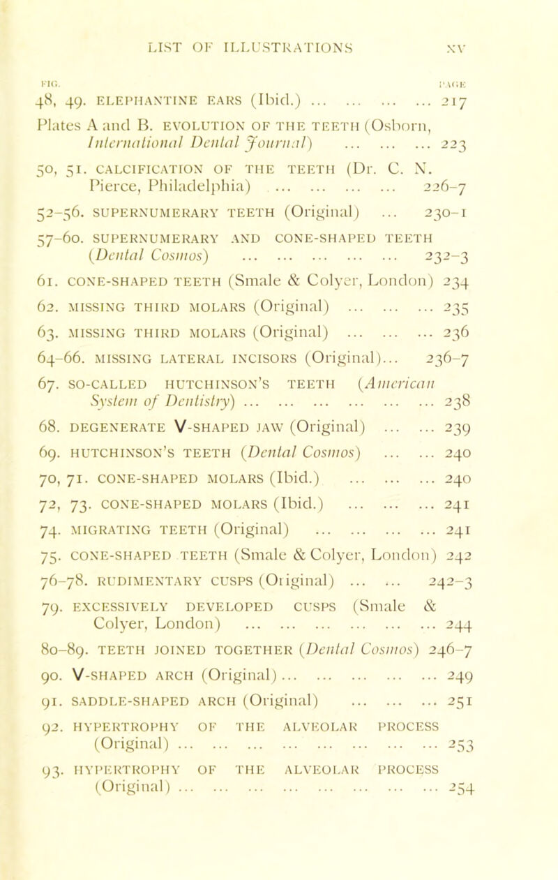 Ui Ui FIG. I'Af.Ii 48, 49. ELEPHANTINE EARS (Ibid.) 217 Plates A and B. evolution of the teeth (Osborn, International Dental Journal) 223 50, 51. CALCIFICATION OF THE TEETH (Dr. C. N. Pierce, Philadelphia) 226-7 2-56. supernumerary teeth (Original) ... 230-1 7-60. supernumerary and cone-shaped teeth (Dental Cosmos) 232-3 61. cone-shaped teeth (Smale & Colyer, London) 234 62. MISSING third molars (Original) 235 63. missing third molars (Original) 236 64-66. MISSING LATERAL INCISORS (Original)... 236-7 67. so-called Hutchinson’s teeth (American System of Dentistry) 238 239 240 240 241 241 68. degenerate V-shaped jaw (Original) ... 69. Hutchinson’s teeth (Dental Cosmos) 70. 71. cone-shaped molars (Ibid.) 72, 73. cone-shaped molars (Ibid.) 74. migrating teeth (Original) 75. cone-shaped teeth (Smale & Colyer, London) 242 76-78. rudimentary cusps (Original) 242-3 79. excessively developed cusps (Smale & Colyer, London) 244 80-89. teeth joined together (Dental Cosmos) 246-7 90. V-shaped arch (Original) 249 91. saddle-shaped arch (Original) 251 92. HYPERTROPHY OF THE ALVEOLAR PROCESS (Original) 253 93. HYPERTROPHY OF THE ALVEOLAR PROCESS (Original) 254