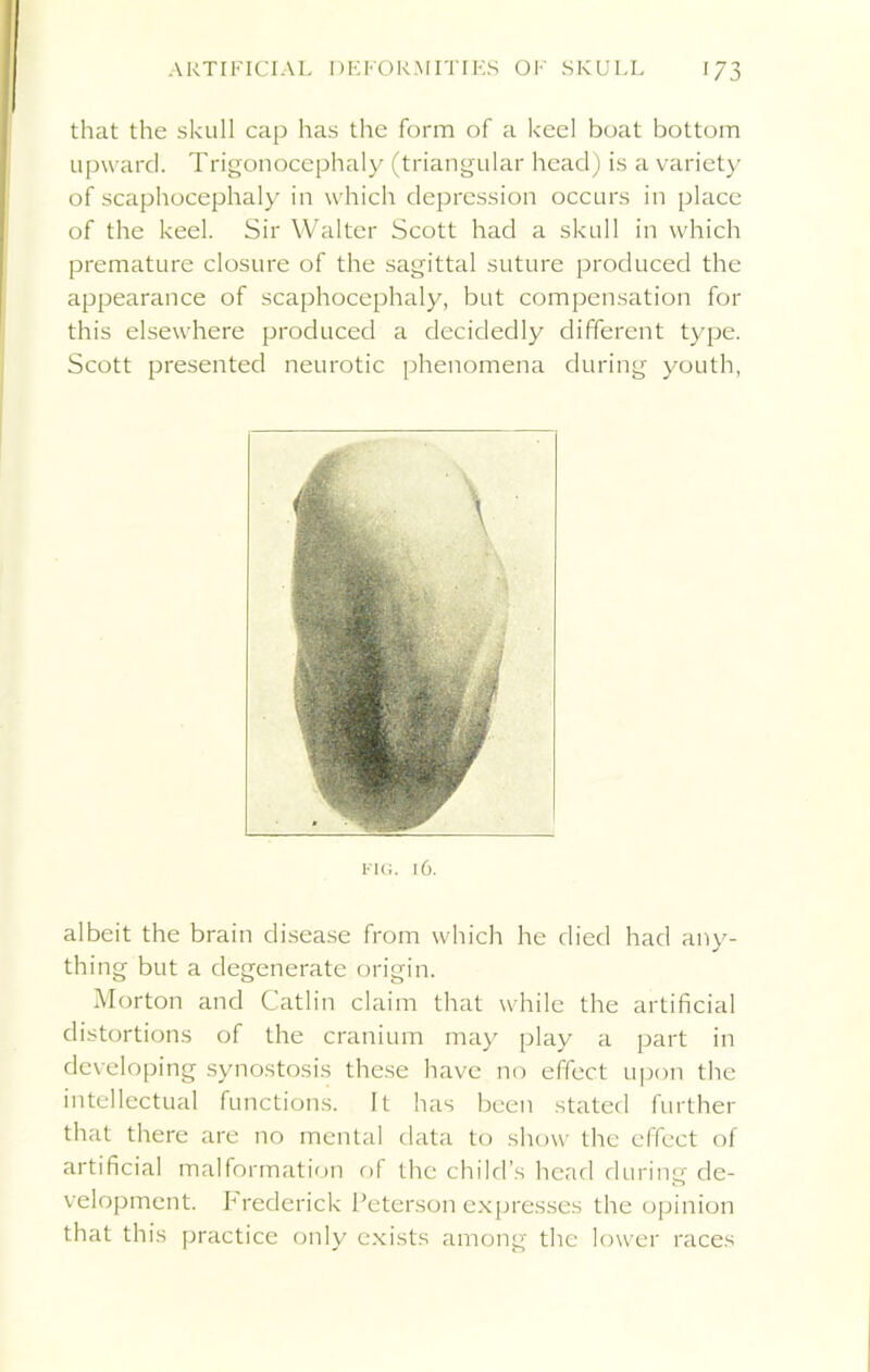 that the skull cap has the form of a keel boat bottom upward. Trigonocephaly (triangular head) is a variety of scaphocephaly in which depression occurs in place of the keel. Sir Walter Scott had a skull in which premature closure of the sagittal suture produced the appearance of scaphocephaly, but compensation for this elsewhere produced a decidedly different type. Scott presented neurotic phenomena during youth, l-IG. 16. albeit the brain disease from which he died had any- thing but a degenerate origin. Morton and Gatlin claim that while the artificial distortions of the cranium may play a part in developing synostosis these have no effect upon the intellectual functions. It has been stated further that there are no mental data to show the effect of artificial malformation of the child’s head during de- velopment. hrederick Peterson expresses the opinion that this practice only exists among the lower races