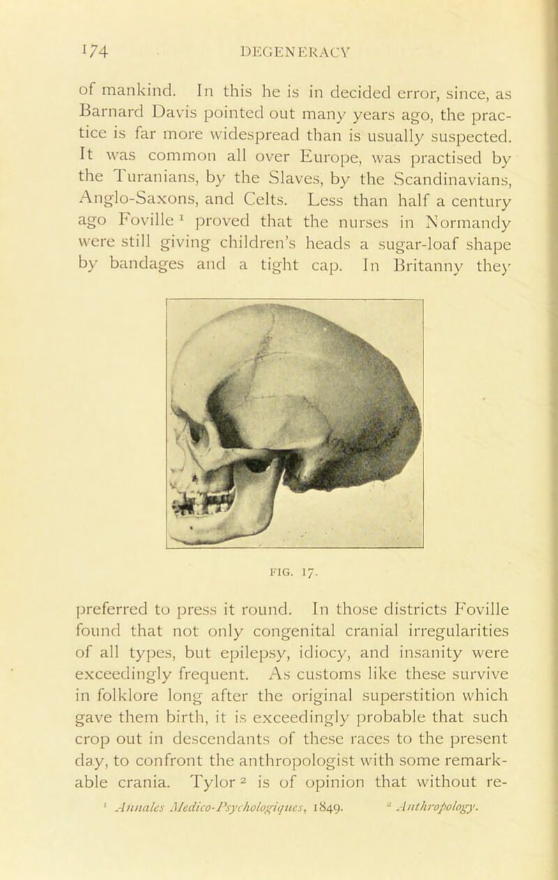 of mankind. In this he is in decided error, since, as Barnard Davis pointed out many years ago, the prac- tice is far more widespread than is usually suspected. It was common all over Europe, was practised by the 1 uranians, by the Slaves, by the Scandinavians, Anglo-Saxons, and Celts. Less than half a century ago hoville1 proved that the nurses in Normandy were still giving children’s heads a sugar-loaf shape by bandages and a tight cap. In Britanny they fig. 17. preferred to press it round. In those districts Foville found that not only congenital cranial irregularities of all types, but epilepsy, idiocy, and insanity were exceedingly frequent. As customs like these survive in folklore long after the original superstition which gave them birth, it is exceedingly probable that such crop out in descendants of these races to the present day, to confront the anthropologist with some remark- able crania. Tylor2 is of opinion that without re- 1 Am tales Medico-Psychologiques, 1849. -Anthropology.