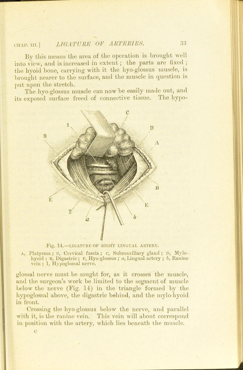 oiiAi*. in. I LiaATURbj OF A HTEUIER. By this means the area of the operation is brought well into view, and is increased in extent; the parts are fixed ; the li5^oid bone, carrying with it the hyo-glossus muscle, is brought nearer to the surface, and the muscle in question is put upon the stretch. The hyo-glossus muscle can now be easily made out, and its exposed surface freed of connective tissue. The hy[>o- Fig. 14.—LlfiATl’RK OF RIGHT LINGUAL ARTERY. A, Platy.sma; R, Cervical fa.scia; c, Subina.xillary gland ; n, lilylo- hyoid ; K, Digastric ; F, Hyo-glossus a, Lingual artery ; h, Eanine vein ; 1, Hyj)oglossal nerve. glossal nerve must be sought for, as it crosses the muscle, and the surgeon’s work be limited to the segment of muscle below the nerve (Fig. 14) in the triangle formed by the hypoglossal above, the digastric behind, and the mylo-liyoid in front. Crossing the hyo-glossus below the nerve, and parallel with it, is the ranine vein. This vein will about correspond in position with the artery, which lies beneath the muscle, c