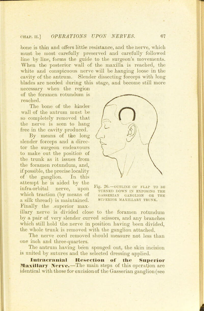 bone is thin and oflers little resistance, and the nerve, which must be most carefully preserved and carefully followed line by line, forms the guide to the surgeon’s movements. When the posterior wall of the maxilla is reached, the white and conspicuous nerve will be hanging loose in the cavity of the antrum. Slender dissecting forceps with long blades are needed during this stage, and become still more necessary when the region of the foramen rotundum is reached. The bone of the hinder wall of the antrum must be so completely removed that the nerve is seen to hang free in the cavity produced. By means of the long slender forceps and a direc- tor the surgeon endeavours to make out the position of the trunk as it issues from the foramen rotundum, and, if possible, the precise locality of the ganglion. In this attempt he is aided by the infra-orbital nerve, upon which traction (by means of a silk thread) is maintained. Finally the .superior max- illary nerve is divided close to the foramen rotundum by a pair of very slender curved scis.sors, and any branches which still hold the nerve in position having been divided, the whole trunk is removed with the ganglion attached. The nerve cord removed should measure not less than one inch and thi’ee-quarters. The antrum having been sponged out, the skin incision is united by sutures and the selected dressing applied. Intracranial Keiscction of tlic Superior JTlaxillary Nerve.—The main steps of this operation are identical with those fo)- excision of the Gasserian ganglion (see Fig. 2B.—OUTLINE OF FLAP TO BE TURNED DOWN IN EXPOSING THE GASSERIAN GANGLION OR THE SUi'ERIOR MAXILLARY TRUNK.