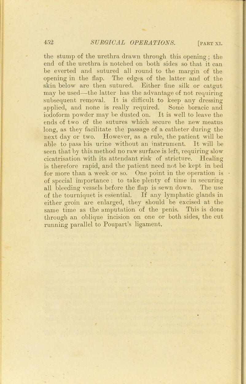 the stump of the urethra drawn through this opening; the end of the urethra is notclied on both sides so that it can be everted and sutured all round to the margin of the opening in the flap. The edges of the latter and of the skin below are then sutured. Either fine silk or catgut may be used—the latter has the advantage of not requiring subsequent removal. It is difficult to keep any dressing applied, and none is really required. Some boracic and iodoform powder may be dusted on. It is well to leave the ends of two of the sutures which secure the new meatus long, as they facilitate the passage of a catheter during the next day or two. However, as a rule, the patient will be able to pass his ui-ine without an instrument. It will be seen that by this method no raw surface is left, requiring slow cicatrisation with its attendant risk of stricture. Healing is therefore rapid, and the patient need not be kept in bed for more than a week or so. One point in the operation is of special impoi'tance : to take plenty of time in securing all bleeding vessels before the flap is sewn down. The use of the tourniquet is essential. If any lymphatic glands in either gi’oin are enlai’ged, they should be excised at the same time as the amputation of the penis. This is done through an oblique incision on one or both sides, the cut runnirig parallel to Poupart’s ligament.