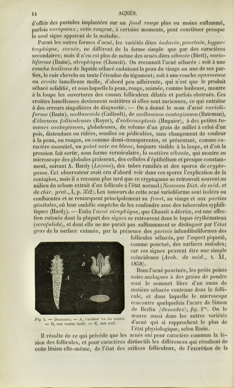 (l’offrir des pustules implantées sur un fond rouge plus ou moins enflammé, variqueiix; cette rougeur, à certains moments, peut constituer presque le seul signe apparent de la maladie. Parmi les autres formes d’acné, les variétés dites indurée ^'ponctuée, hyper- tropliique, cornée, ne diffèrent de la forme simple que par des caractères secondaires; mais il n’en est plus de même des acnés dites sébacée (Biett), vario- liforme (Bazin), atrophique (Cliausit). On reconnaît l’acné sébacée : soit à une couche huileuse de liquide sébacé enduisant la peau du visage ou une de ses par- ties, le cuir chevelu ou toute l’étendue du tégument; soit à une couche squameuse ou croûte lamelleuse molle, d’abord peu adhérente, cjui n’est ([ue le produit sébacé solidifié, et sous laquelle la peau, rouge, animée, comme huileuse, montre à la loupe les ouvertures des canaux folliculeux dilatés et parfois obstrués. Ces croûtes lamelleuses deviennent noirâtres si elles sont anciennes, ce ([ui entraîne à des erreurs singulières de diagnostic. — On a donné le nom d’acné varioli- forme (Bazin), molluscoïde (Caillault), de molluscum (Bateman), (Vélevures follicideuses (Rayer), ecdermoptosis (Huguier), à des petites tu- meurs contagieuses, globuleuses, du volume d’un grain de millet à celui d’un pois, distendues ou ridées, sessiles ou pédiculées, sans changement de couleur à la peau, ou rouges, ou comme demi-transparentes, et présentant, comme ca- ractère essentiel, un point noir ou blanc, toujours visible à la loupe, et d’où la pression fait sortir, sous forme vermiculaire, la matière sébacée, qui montre au microscope des globules graisseux, des cellules d’épithélium et prescjue constam- ment, suivant A. Hardy {Leçons), des tubes ramifiés et des spores de crypto- game. Cet observateur avait cru d’abord voir dans ces spores l’explication de la contagion, mais il a reconnu plus tard que ce cryptogame se retrouvait souvent au milieu du sébum extrait d’un follicule à l’état normal {Nouveau Dict. de méd. et de chir. prat., I, p. 352). Les tumeurs de cette acné varioliforme sont isolées ou confluentes et se remarquent principalement au front, au visage et aux parties génitales, où leur ombilic empêche de les confondre avec des tubercules syphili- tiques (Hardy). — Enfin Vacné atrophique, que Chausit a décrite, estime affec- tion cutanée dont la plupart des signes se retrouvent dans le lupus érythémateux {scrofulide), et dont elle ne me paraît pas suffisamment se distinguer par Vétat gras de la surface cutanée, par la présence des perluis infundibuliformes des follicules sébacés, par l’aspect piqueté, comme ponctué, des surfaces malades; car ces signes peuvent être une simple coïncidence {Arch. de méd., t. XI, 1858). Dans l’acné ponctuée, les petits points noirs analogues à des grains de poudre sont le sommet libre d’un amas de matière sébacée contenue dans le folli- cule, et dans laquelle le microscope rencontre quelquefois l’acare de Simon de Berlin (demodex), fig. H®. On le trouve aussi dans les autres variétés d’acné qui si rapprochent le plus de l’état physiologique, selon Bazin. 11 résulte de ce qui précède que les acnés ont pour caractère commun la lé- sion des follicules, et pour caractères distinctifs les dilférences qui résultent de cette lésion elle-même, de l’état des orifices folliculeux, de l’excrétion de la /'V(/ 1. — Deiiiude.v. — A, l’auiLual vu du veuLre. — B, son voslrc isolé. — C, son œuf.