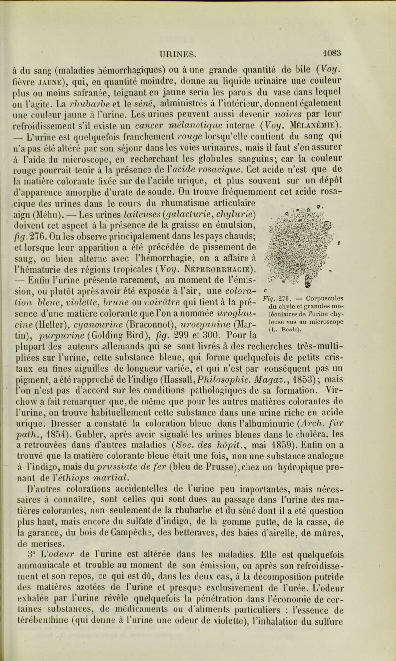 g;«î Fig. 276. — Corpuscules du chyle et granules mo- léculaires de l’urine chy- leuse vus au microscope (L. Beale). à du sang (maladies hémorrhagiques) ou aune grande quantité de bile {Voy. fièvre jaune), qui, en quantité moindre, donne au liquide urinaire une couleur [>lus ou moins safranée, teignant en jaune serin les parois du vase dans lequel on fagite. La rhuharhe et le séné, administrés à l’intérieur, donnent également une couleur jaune à l’iirine. Les urines peuvent aussi devenir noires par leur refroidissement s’il existe un cancer mélanotiquc interne {Voy. Mélanémie). — L’urine est quelquefois franchement rouge lorsqu’elle contient du sang qui n’a pas été altéré par son séjour dans les voies urinaires, mais il faut s’en assurer cà l’aide du microscope, en recherchant les globules sanguins; car la couleur rouge pourrait tenir à la présence de Vacide rosacique. Cet acide n’est que de la matière colorante fixée sur de l’acide urique, et plus souvent sur un dépôt d’apparence amorphe d’urate de soude. On trouve fréquemment cet acide rosa- ,cique des urines dans le cours du rhumatisme articulaire aigu (Méhu). — Les urines laiteuses {galacturie, chylurie) doivent cet aspect à la présence de la graisse en émulsion, /jgf.276. On les observe principalement dans les pays chauds; et lorsque leur apparition a été précédée de pissement de sang, ou bien alterne avec l’hémorrhagie, on a affaire à l’hématurie des régions tropicales {Voy. Néphrorrhagie). — Enfin l’urine présente rarement, au moment de l’émis- sion, ou plutôt après avoir été exposée à l’air, une colora- tion hleue, violette, brune ou noirâtre qui lient à la pré- sence d’une matière colorante que l’on a nommée uroglau- cine (Relier), cyanourine (Braconnot), urocyanine (Mar- tin), qmrjpurine (Golding Bird), fig. 299 et 300. Pour la plupart des auteurs .allemands qui se sont livrés à des recherches très-multi- pliées sur l’urine, cette substance bleue, qui forme quelquefois de petits cris- taux en fines aiguilles de longueur variée, et qui n’est par conséquent pas un pigment, a été rapproché dePindigo {EslssbW, Philosophie. Magaz., 1853); mais l’on n’est pas d’accord sur les conditions pathologiques de sa formation. Vir- chow a fait remarquer que, de même que pour les autres matières colorantes de l’urine, on trouve habituellement cette substance clans une urine riche en acide urique. Dresser a constaté la coloration bleue dans l’albuminurie {Arch. fur path., 1854). Gubler, après avoir signalé les urines bleues dans le choléra, les a retrouvées dans d’autres maladies {Soc. des hôpit., mai 1859). Enfin on a trouvé que la matière colorante bleue était une fois, non une substance analogue à l’indigo, mais du prussiate de fer (bleu de Prusse), chez un hydropifiue pre- nant de Véthiops martial. D’autres colorations accidentelles de l’urine peu importantes, mais néces- saires à connaître, sont celles qui sont dues au passage dans l’urine des ma- tières colorantes, non- seulement de la rhubarbe et du séné dont il a été ([uestion plus haut, mais encore du sulfate d’indigo, de la gomme gutte, de la casse, de la garance, du bois deCampêche, des betteraves, des baies d’airelle, de mûres, de merises. 3“ Vodeur de l’urine est altérée dans les maladies. Elle est quelquefois ammoniacale et trouble au moment de son émission, ou après son refroidisse- ment et son repos, ce qui est dû, dans les deux cas, à la décomposition putride des matières azotées de l’urine et presque exclusivement de l’urée. L’odeur exhalée par l’urine révèle quelquefois la pénétration dans l’économie de cer- taines substances, de médicaments ou d’aliments particuliers : l’essence do lérébeiilhine (qui donne à l’urine une odeur de violette), l’inhalation du sulfure