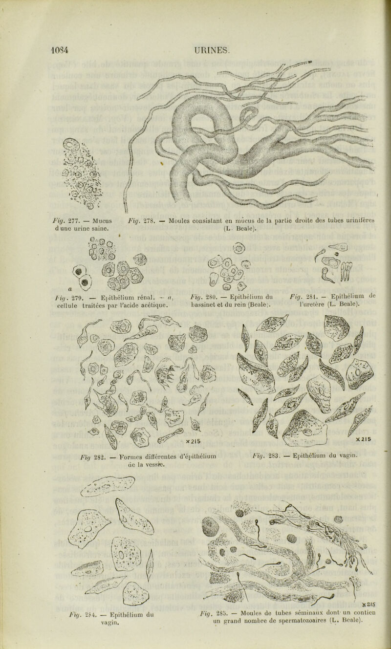' ''*^ji|i'.ilM' ■3Ssai.'» ''‘iinasmr'' /<'iÿ. 277. — Mucus Fi(/. 278. — d une urine saine. J'VJ. 279. — E[iithélium rénal. — cellule traitées par Facide acétique Moules consistant en mucus de la partie droite des tubes urinifères (L. Beale). Fi(j. 280. — Epithélium du Firj. 281. — Epithélium de bassinet et du rein (Beale;. l’uretère (L. Beale). Fi(j 282. — Formes didérentes d’épithélium do la vessie. Fifi- 284, — Epithélium du vagin. Fig. 28ü. — Moules de tubes séminaux dont- un contien un grand nombre de spermatozoaires (L. Beale).