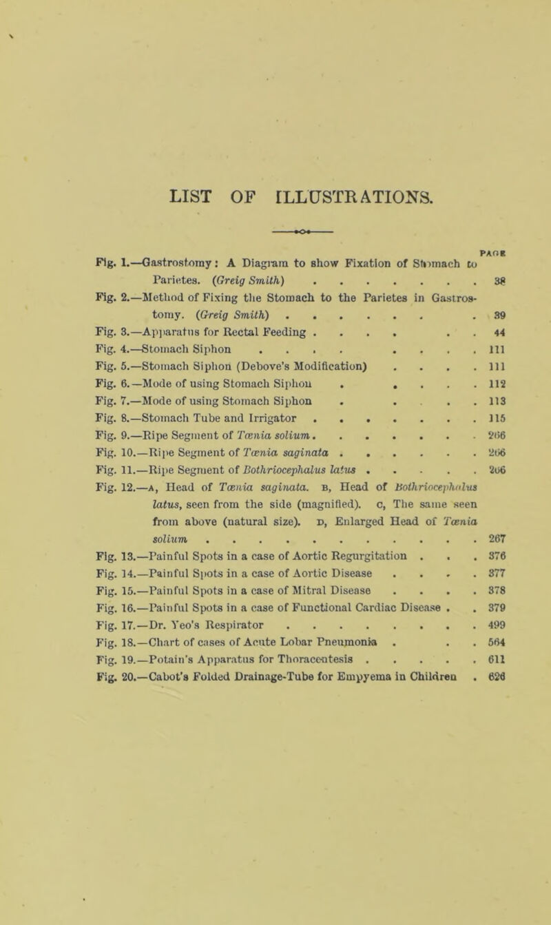 LIST OF ILLUSTRATIONS. PA fig Fig. 1.—Gastrostomy: A Diagram to show Fixation of Stomach to Parietes. (Greig Smith) 3? Fig. 2.—Method of Fixing the Stomach to the Parietes in Gastros- tomy. (Greig Smith) . 39 Fig. 3.—Apparatus for Rectal Feeding .... . . 44 Fig. 4.—Stomach Siphon .... .... Ill Fig. 5.—Stomach Siphon (Debove’s Modification) . . . .111 Fig. 6.—Mode of using Stomach Siphon . . . . .112 Fig. 7.—Mode of using Stomach Siphon . ... 113 Fig. 8.—Stomach Tube and Irrigator . . . . . . .115 Fig. 9.—Ripe Segment of Tcenia solium 206 Fig. 10.—Ripe Segment of Tcmia saginata 206 Fig. 11.—Ripe Segment of Bothriocephalus latus 2t>6 Fig. 12.—a, Head of Tcenia saginata. b, Head of Bothriocepholus latus, seen from the side (magnified), c, The same seen from above (natural size), d, Enlarged Head of Tcenia solium 267 Fig. 13.—Painful Spots in a case of Aortic Regurgitation . . . 376 Fig. 14.—Painful Spots in a case of Aortic Disease .... 377 Fig. 15.—Painful Spots in a case of Mitral Disease .... 378 Fig. 16.—Painful Spots in a case of Functional Cardiac Disease . . 379 Fig. 17.—Dr. Yeo's Respirator 499 Fig. 18.—Chart of cases of Acute Lobar Pneumonia . . . 564 Fig. 19.—Potain’s Apparatus for Thoracentesis 611 Fig. 20.—-Cabot’s Folded Drainage-Tube for Empyema in Children . 626