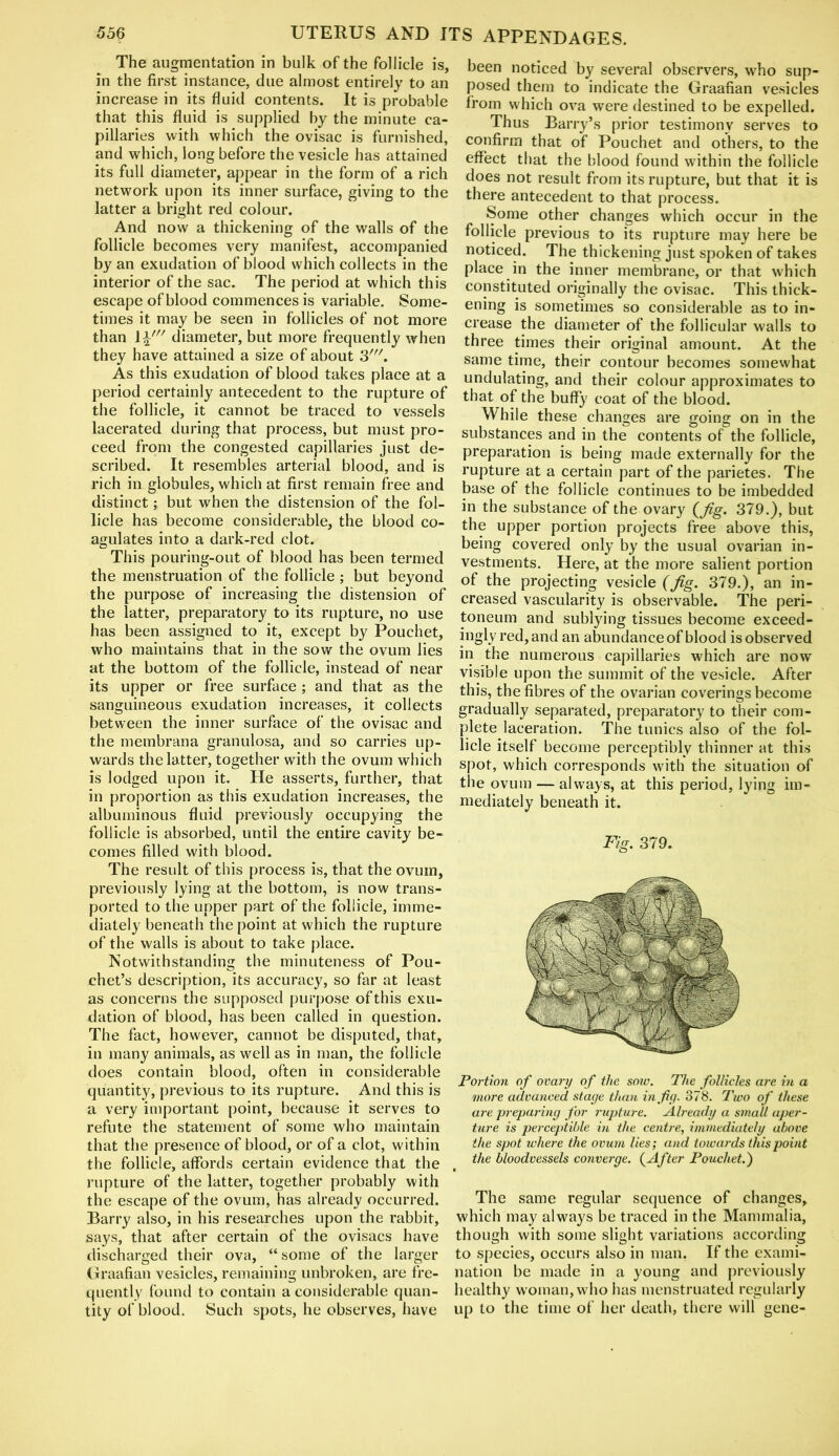 The augmentation in bulk of the follicle is, in the first instance, due almost entirely to an increase in its fluid contents. It is probable that this fluid is supplied by the minute ca- pillaries with which the ovisac is furnished, and which, long before the vesicle has attained its full diameter, appear in the form of a rich network upon its inner surface, giving to the latter a bright red colour. And now a thickening of the walls of the follicle becomes very manifest, accompanied by an exudation of blood which collects in the interior of the sac. The period at which this escape of blood commences is variable. Some- times it may be seen in follicles of not more than \\' diameter, but more frequently when they have attained a size of about 3'. As this exudation of blood takes place at a period certainly antecedent to the rupture of the follicle, it cannot be traced to vessels lacerated during that process, but must pro- ceed from the congested capillaries just de- scribed. It resembles arterial blood, and is rich in globules, which at first remain free and distinct; but when the distension of the fol- licle has become considerable, the blood co- agulates into a dark-red clot. This pouring-out of blood has been termed the menstruation of the follicle ; but beyond the purpose of increasing the distension of the latter, preparatory to its rupture, no use has been assigned to it, except by Pouchet, who maintains that in the sow the ovum lies at the bottom of the follicle, instead of near its upper or free surface ; and that as the sanguineous exudation increases, it collects between the inner surface of the ovisac and the membrana granulosa, and so carries up- wards the latter, together with the ovum which is lodged upon it. He asserts, further, that in proportion as this exudation increases, the albuminous fluid previously occupying the follicle is absorbed, until the entire cavity be- comes filled with blood. The result of this process is, that the ovum, previously lying at the bottom, is now trans- ported to the upper part of the follicle, imme- diately beneath the point at which the rupture of the walls is about to take place. Notwithstanding the minuteness of Pou- chet’s description, its accuracy, so far at least as concerns the supposed purpose of this exu- dation of blood, has been called in question. The fact, however, cannot be disputed, that, in many animals, as well as in man, the follicle does contain blood, often in considerable quantity, previous to its rupture. And this is a very important point, because it serves to refute the statement of some who maintain that the presence of blood, or of a clot, within the follicle, affords certain evidence that the rupture of the latter, together probably with the escape of the ovum, has already occurred. Barry also, in his researches upon the rabbit, says, that after certain of the ovisacs have discharged their ova, “ some of the larger Graafian vesicles, remaining unbroken, are fre- quently found to contain a considerable quan- tity of blood. Such spots, he observes, have been noticed by several observers, who sup- posed them to indicate the Graafian vesicles from which ova were destined to be expelled. Thus Barry’s prior testimony serves to confirm that of Pouchet and others, to the effect that the blood found within the follicle does not result from its rupture, but that it is there antecedent to that process. Some other changes which occur in the follicle previous to its rupture may here be noticed. The thickening just spoken of takes place in the inner membrane, or that which constituted originally the ovisac. This thick- ening is sometimes so considerable as to in- crease the diameter of the follicular walls to three times their original amount. At the same time, their contour becomes somewhat undulating, and their colour approximates to that of the buffy coat of the blood. While these changes are going on in the substances and in the contents of the follicle, preparation is being made externally for the rupture at a certain part of the parietes. The base of the follicle continues to be imbedded in the substance of the ovary (Jig. 379.), but the upper portion projects free above this, being covered only by the usual ovarian in- vestments. Here, at the more salient portion of the projecting vesicle (Jig. 379.), an in- creased vascularity is observable. The peri- toneum and sublying tissues become exceed- ingly red, and an abundance of blood is observed in the numerous capillaries which are now visible upon the summit of the vesicle. After this, the fibres of the ovarian coverings become gradually separated, preparatory to their com- plete laceration. The tunics also of the fol- licle itself become perceptibly thinner at this spot, which corresponds with the situation of the ovum — always, at this period, lying im- mediately beneath it. Fig. 379. Portion of ovary of the sow. The follicles are in a more advanced stage than in fig. 378. Two of these are preparing for rupture. Already a small aper- ture is perceptible in the centre, immediately above the spot where the ovum lies; and towards this point the bloodvessels converge. (After Pouchet.') The same regular sequence of changes, which may always be traced in the Mammalia, though with some slight variations according to species, occurs also in man, If the exami- nation be made in a young and previously healthy woman, who has menstruated regularly up to the time of her death, there will gene-