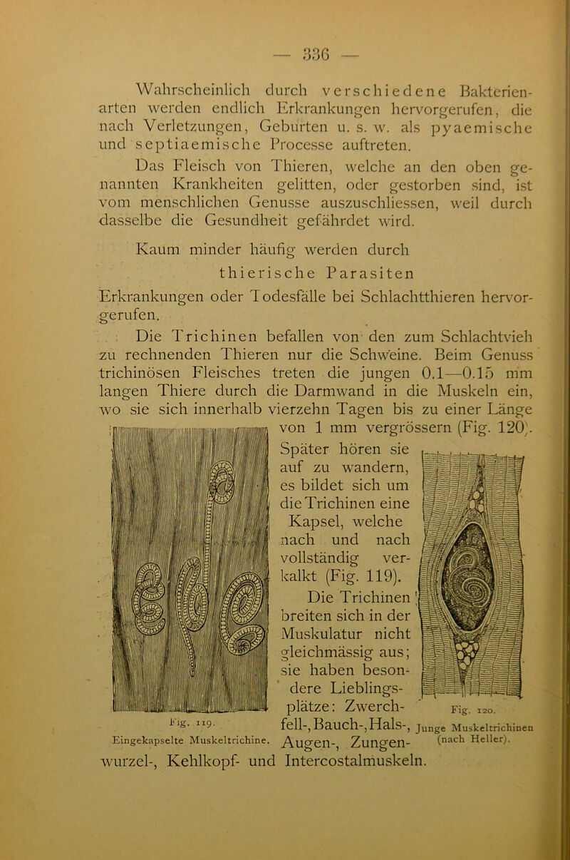 Wahrscheinlich durch verschiedene Bakterien- arten werden endlich Erkrankungen hervorgerufen, die nach Verletzungen, Geburten u. s. w. als pyaemische und septiaemische Processe auftreten. Das Fleisch von Thieren, welche an den oben ge- nannten Krankheiten gelitten, oder gestorben sind, ist vom menschlichen Genüsse auszuschliessen, weil durch dasselbe die Gesundheit gefährdet wird. Kaum minder häufig werden durch t hie rische Parasiten Erkrankungen oder Todesfälle bei Schlachtthieren hervor- gerufen. Die Trichinen befallen von den zum Schlachtvieh zu rechnenden Thieren nur die Schweine. Beim Genuss trichinösen Fleisches treten die jungen 0.1—0.15 mm langen Thiere durch die Darmwand in die Muskeln ein, wo sie sich innerhalb vierzehn Tagen bis zu einer Länge von 1 mm vergrössern (Fig. 120,'. Später hören sie auf zu wandern, es bildet sich um die Trichinen eine Kapsel, welche nach und nach vollständig ver- kalkt (Fig. 119). Die Trichinen breiten sich in der Muskulatur nicht gleichmässig aus; sie haben beson- dere Lieblings- plätze: Zwerch- i*'ig. 119. Eingekapselte Muskeltrichine. Fig. 120. feil-, Bauch-, Hals-, Junge Muskeltrichinen Augen-, Zungen- (nach Heller)- Wurzel-, Kehlkopf- und Intercostalmuskeln.