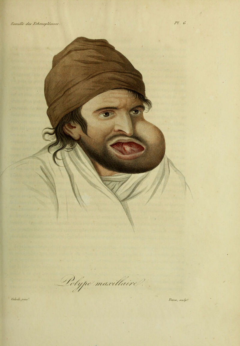 fiatnt/Ze <z&r J^tA/no/>'écoses. ^r/////r y////, / v fa/vt/e, pi/ire. Tresca,, *fcu&> *T