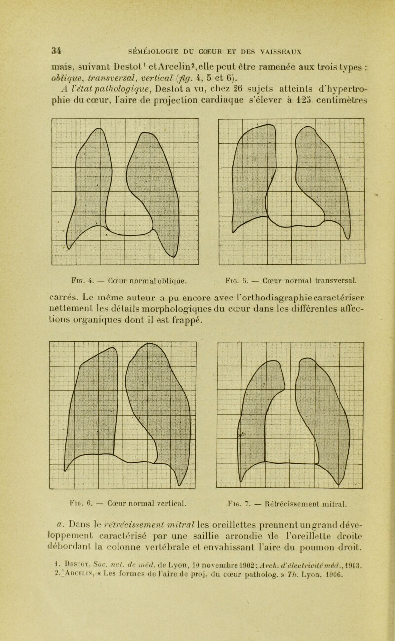 mais, suivant Destot1 et Arcelin2, elle peut être ramenée aux trois types : oblique, transversal, vertical [fig. 4, 5 et 6). A Vétat pathologique, Destot a vu, chez 26 sujets atteints d’hypertro- phie du cœur, l’aire de projection cardiaque s’élever à 125 centimètres Fig. 4. — Cœur normal oblique. Fig. 5. — Cœur normal transversal. carrés. Le même auteur a pu encore avec l’orthodiagraphiecaractériser nettement les détails morphologiques du cœur dans les différentes affec- tions organiques dont il est frappé. Fig. 6. — Cœur normal vertical. Fig. 1. — Rétrécissement mitral. a. Dans le rétrécissement mitral les oreillettes prennent un grand déve- loppement caractérisé par une saillie arrondie de l’oreillette droite débordant la colonne vertébrale et envahissant l’aire du poumon droit. 1. Destot, Soc. nul. de méd. de Lyon, 10 novembre 1902; Avc/i. d'électricitéméd., 1903. 2/Aucelin, « Les formes de Faire de proj. du cœur patliolog. » Th. Lyon. 1006.