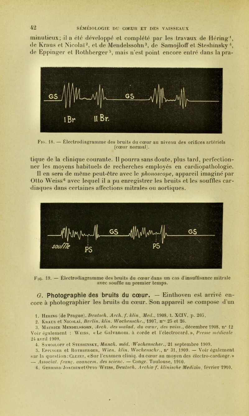 minutieux; il a été développé et complété par les travaux de Béring’, de Kraus et Nicolaï1 2, et de Mendelssohn3 4 5, de Samojloff et Steshinsky de Eppinger et Rothberger8, mais n’est point encore entré dans la pra- Fig. 18. — Électrodiagramme des bruits du cœur au niveau des orifices artériels (cœur normal). tique de la clinique courante. Il pourra sans doute, plus tard, perfection- ner les moyens habituels de recherches employés en cardiopathologie. Il en sera de même peut-être avec le phonoscope, appareil imaginé par Otto Weiss6 avec lequel il a pu enregistrer les bruits et les souffles car- diaques dans certaines affections mitrales ou aortiques. Fig- 19- — Électrodiagramme des bruits du cœur dans un cas d'insuffisance mitrale avec souffle au premier temps. G. Photographie des bruits du cœur. — Einthoven est arrivé en- core à photographier les bruits du cœur. Son appareil se compose d'un 1. Hering (de Prague), Deutscli. Arch. f. klin. Med., 1908, t. XC1V, p. 203. 2. Kraus et Nicolaï, Berlin, klin. Wochensche., 1907. ns 25 et 26. 3. Maurice Mendelssohn, Arch. des ma/ad. du cœur, des vaiss., décembre 1908, n° 12 Voir également : Weiss, «Le Galvanom. à corde et l’électrocard.», Presse médicale 24 avril 1909. 4. Samojloff et Steshinsky, Munch. méd. Wochenscher., 21 septembre 1909. 5. Eppinger et Rothrerger, Wien. klin. Wochenschr., n° 31, 1909. — Voir également sur la question:Clu/.et, «Sur l’examen cliniq. du cœur au moyen des électro-c-ardiogr. » — Associai, franç. avancent, des scienc. — Congr. Toulouse, 1910. 6. Gerhard Joachim et Otto Weiss, Deulsch. Arc hiv f. klinische Medizin, février 1910.