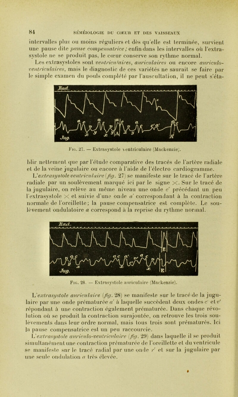 intervalles plus ou moins réguliers et dès qu elle est terminée, survient une pause ditz pause compensatrice ; enfin dans les intervalles où l’extra- systole ne se produit pas, le cœur conserve son rythme normal. Les extrasystoles sont ventriculaires, auriculaires ou encore auriculo- ventriculaires, mais le diagnostic de ces variétés ne saurait se faire par le simple examen du pouls complété par l'auscultation, il ne peut s’éla- Fir,. 27. — Extrasystole \entriculaire (Mackenzie}. blir nettement que par l’étude comparative des tracés de l’artère radiale et de la veine jugulaire ou encore à l’aide de l’électro cardiogramme. L'extrasystole ventriculaire [fig. 27) se manifeste sur le tracé de l'artère radiale par un soulèvement marqué ici par le signe X. Sur le tracé de la jugulaire, on relève au même niveau une onde c précédant un peu l'extrasystole X et suivie d’une onde a correspondant à la contraction normale de l’oreillette ; la pause compensatrice est complète. Le sou- lèvement ondulatoire a correspond à la reprise du rythme normal. Fig. 28. — Extrasystole auriculaire (Mackenzie). L'ex Ira systole auriculaire [ficj. 28) se manifeste sur le tracé de la jugu- laire par une onde prématurée a à laquelle succèdent deux ondes c elV répondant à une contraction également prématurée. Dans chaque révo- lution où se produit la contraction surajoutée, on retrouve les trois sou- lèvements dans leur ordre normal, mais tous trois sont prématurés. Ici la pause compensatrice est un peu raccourcie. L'extrasystole auriculo-ventriculaire [ftp. 29) dans laquelle il se produit simultanément une contraction prématurée de l’oreillette et du ventricule se manifeste snr le tracé radial par une onde r et sur la jugulaire par une seule ondulation a très élevée. »