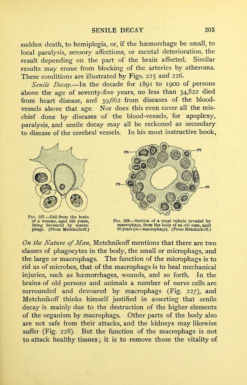 sudden death, to hemiplegia, or, if the haemorrhage be small, to local paralysis, sensory affections, or mental deterioration, the result depending on the part of the brain affected. Similar results may ensue from blocking of the arteries by atheroma. These conditions are illustrated by Figs. 225 and 226. Senile Decay.—In the decade for 1891 to 1900 of persons above the age of seventy-five years, no less than 34)^22 died from heart disease, and 39,662 from diseases of the blood- vessels above that age. Nor does this even cover all the mis- chief done by diseases of the blood-vessels, for apoplexy, paralysis, and senile decay may all be reckoned as secondary to disease of the cerebral vessels. In his most instructive book, On the Nature of Man., Metchnikoff mentions that there are two classes of phagocytes in the body, the small or microphags, and the large or macrophags. The function of the microphags is to rid us of microbes, that of the macrophags is to heal mechanical injuries, such as haemorrhages, wounds, and so forth. In the brains of old persons and animals a number of nerve cells are surrounded and devoured by macrophags (Fig. 227), and Metchnikoff thinks himself justified in asserting that senile decay is mainly due to the destruction of the higher elements of the organism by macrophags. Other parts of the body also are not safe from their attacks, and the kidneys may likewise suffer (Fig. 228). But the function of the macrophags is not to attack healthy tissues; it is to remove those the vitality of Fig. 227.—Cell from the brain of a woman, aged 100 years, being devoured by maoro- phags. (From Metchnikoff.) Fio. 228.—Section of a renal tubule invaded by macrophags, from the body of an old man, aged 90 years (to=macrophags). (From Metchnikoff.)