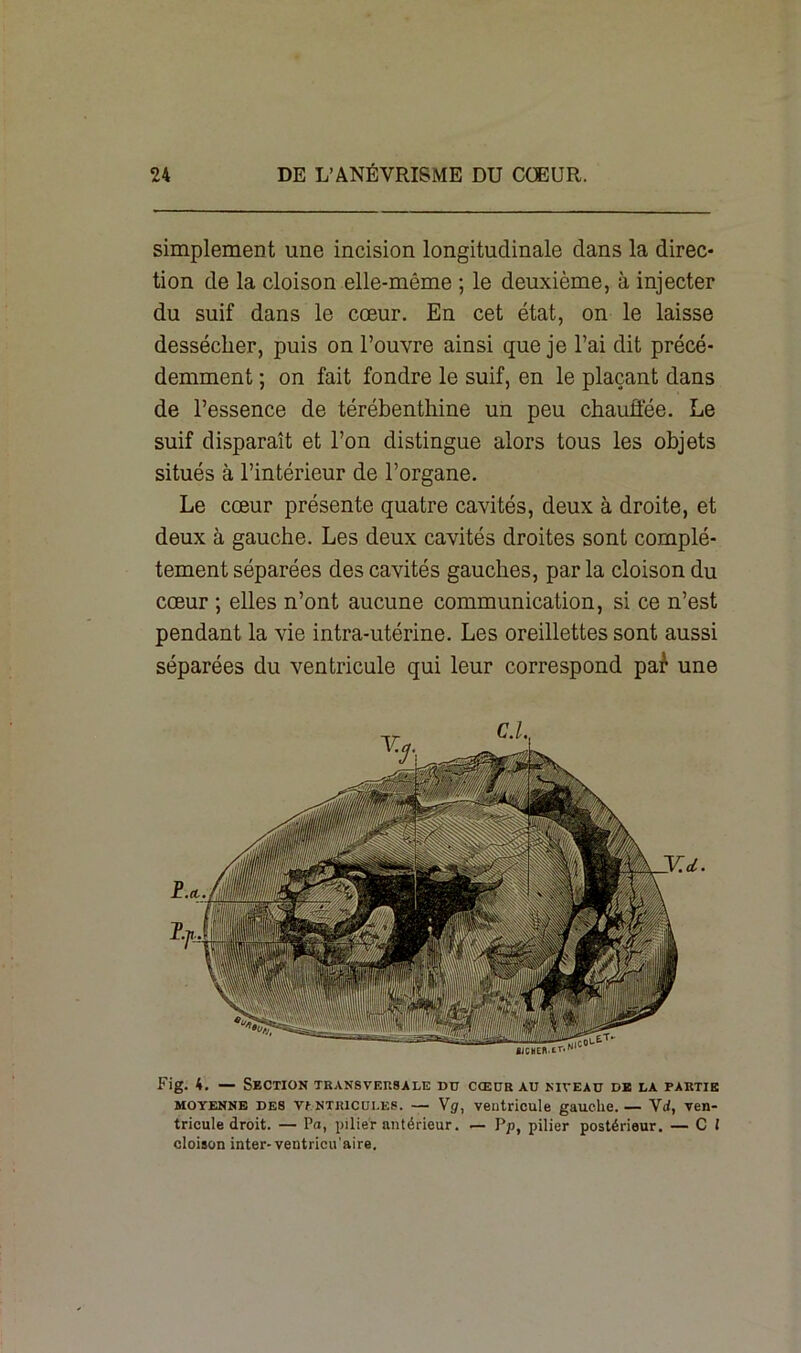 simplement une incision longitudinale dans la direc- tion de la cloison elle-même ; le deuxième, à injecter du suif dans le cœur. En cet état, on le laisse dessécher, puis on l’ouvre ainsi que je l’ai dit précé- demment ; on fait fondre le suif, en le plaçant dans de l’essence de térébenthine un peu chauffée. Le suif disparaît et l’on distingue alors tous les objets situés à l’intérieur de l’organe. Le cœur présente quatre cavités, deux à droite, et deux à gauche. Les deux cavités droites sont complè- tement séparées des cavités gauches, par la cloison du cœur ; elles n’ont aucune communication, si ce n’est pendant la vie intra-utérine. Les oreillettes sont aussi séparées du ventricule qui leur correspond pa£ une Fig. 4. — Section transversale du cœur au niveau de la partie moyenne DES \t ntkicui.es. — Vg, ventricule gauche. — Vrf, ven- tricule droit. — Pa, pilier antérieur. — Pp, pilier postérieur. — C l cloison inter- ventricu'aire.