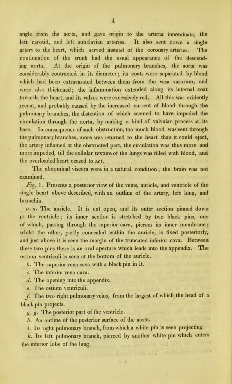 angle from the aorta, and gave origin to the arteria innominata, the left carotid, and left subclavian arteries. It also sent down a single artery to the heart, which served instead of the coronary arteries. The continuation of the trunk had the usual appearance of the descend- ing aorta. At the origin of the pulmonary branches, the aorta was considerably contracted in its diameter; its coats were separated by blood which had been extravasated between them from the vasa vasorum, and were also thickened; the inflammation extended along its internal coat tow ards the heart, and its valves w ere excessively red. All this w7as evidently recent, and probably caused by the increased current of blood through the pulmonary branches, the distention of which seemed to have impeded the circulation through the aorta, by making a kind of valvular process at its base. In consequence of such obstruction, too much blood w as sent through the pulmonary branches, more was returned to the heart than it could eject, the artery inflamed at the obstructed part, the circulation w7as thus more and more impeded, till the cellular texture of the lungs was filled with blood, aud the overloaded heart ceased to act. The abdominal viscera were in a natural condition; the brain w7as not examined. Fig. 1. Presents a posterior view of the veins, auricle, and ventricle of the single heart above described, with an outline of the artery, left lung, and bronchia. a. a. The auricle. It is cut open, and its outer section pinned down to the ventricle; its inner section is stretched by two black pins, one of which, passing through the superior cava, pierces its inner membrane; whilst the other, partly concealed within the auricle, is fixed posteriorly, and just above it is seen the margin of the truucated inferior cava. Between these two pins there is an oval aperture which leads into the appendix. The ostium ventriculi is seen at the bottom of the auricle. b. The superior vena cava with a black pin in it. c. The inferior vena cava* c1. The opening into the appendix. e. The ostium ventriculi. f. The two right pulmonary veins, from the largest of which the head of a black pin projects. g. g. The posterior part of the ventricle. h. An outline of the posterior surface of the aorta. i. Its right pulmonary branch, from which a white pin is seen projecting. k. Its left pulmonary branch, pierced by another white pin which enters the inferior lobe of the lung.