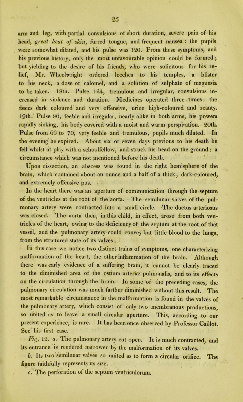 arm and leg, with partial convulsions of short duration, severe pain of his head, great heat of skin, furred tongue, and frequent nausea : the pupils were somewhat dilated, and his pulse was 120. From these symptoms, and his previous history, only the most unfavourable opinion could be formed ; but yielding to the desire of his friends, who were solicitous for his re- lief, Mr. Wheelwright ordered leeches to his temples, a blister to his neck, a dose of calomel, and a solution of sulphate of magnesia to be taken. 18th. Pulse 124, tremulous and irregular, convulsions in- creased in violence and duration. Medicines operated three times: the faeces dark coloured and very offensive, urine high-coloured and scanty. J 9th. Pulse 86, feeble and irregular, nearly alike in both arms, his powders rapidly sinking, his body covered with a moist and warm perspiration. 20th. Pulse from 66 to 70, very feeble and tremulous, pupils much dilated. In the evening he expired. About six or seven days previous to his death he fell whilst at play w ith a schoolfellow7, and struck his head on the ground : a circumstance which was not mentioned before his death. Upon dissection, an abscess was found in the right hemisphere of the brain, which contained about an ounce and a half of a thick, dark-coloured, and extremely offensive pus. Iu the heart there was an aperture of communication through the septum of the ventricles at the root of the aorta. The semilunar valves of the pul- monary artery were contracted into a small circle. The ductus arteriosus was closed. The aorta then, in this child, in effect, arose from both ven- tricles of the heart, owing to the deficiency of the septum at the root of that vessel, and the pulmonary artery could convey but little blood to the lungs, from the strictured state of its valves . In this case we notice two distinct trains of symptoms, one characterizing malformation of the heart, the other inflammation of the brain. Although there was early evidence of a suffering brain, it cannot be clearly traced to the diminished area of the ostium arterige pulmonalis, and to its effects on the circulation through the brain. In some of the preceding cases, the pulmonary circulation w’as much farther diminished without this result. The most remarkable circumstance in the malformation is found in the valves of the pulmonary artery, which consist of only two membranous productions, so united as to leave a small circular aperture. This, according to our present experience, is rare. It has been once observed by Professor Caillot. See his first case. Fig. 12. a. The pulmonary artery cut open. It is much contracted, and its entrance is rendered narrower by the malformation of its valves. h. Its two semilunar valves so united as to form a circular orifice. The figure faithfully represents its size. c. The perforation of the septum ventriculorum.
