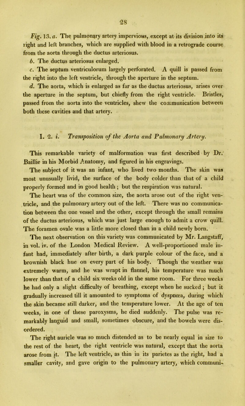 Fig. 13. a. The pulmonary artery impervious, except at its division into its right and left branches, which are supplied with blood in a retrograde course from the aorta through the ductus arteriosus. b. The ductus arteriosus enlarged. c. The septum ventriculorum largely perforated. A quill is passed from the right into the left ventricle, through the aperture in the septum. d. The aorta, which is enlarged as far as the ductus arteriosus, arises over the aperture in the septum, but chiefly from the right ventricle. Bristles, passed from the aorta into the ventricles, shew the communication between both these cavities and that artery. I. 2. i. Transposition of the Aorta and Pulmonary Artery. This remarkable variety of malformation was first described by Dr. Baillie in his Morbid Anatomy, and figured in his engravings. The subject of it was an infant, who lived two months. The skin was most unusually livid, the surface of the body colder than that of a child properly formed and in good health; but the respiration was natural. The heart was of the common size, the aorta arose out of the right ven- tricle, and the pulmonary artery out of the left. There was no communica- tion between the one vessel and the other, except through the small remains of the ductus arteriosus, which was just large enough to admit a crow quill. The foramen ovale was a little more closed than in a child newly born. The next observation on this variety was communicated by Mr. Langstaff, in vol. iv. of the London Medical Review. A well-proportioned male in- fant had, immediately after birth, a dark purple colour of the face, and a brownish black hue on every part of his body. Though the weather was extremely warm, and he was wrapt in flannel, his temperature was much lower than that of a child six weeks old in the same room. For three weeks he had only a slight difficulty of breathing, except when he sucked ; but it gradually increased till it amounted to symptoms of dyspnoea, during which the skin became still darker, and the temperature lower. At the age of ten weeks, in one of these paroxysms, he died suddenly. The pulse was re- markably languid and small, sometimes obscure, and the bowels were dis- ordered. The right auricle was so much distended as to be nearly equal in size to the rest of the heart, the right ventricle was natural, except that the aorta arose from it. The left ventricle, as thin in its parietes as the right, had a smaller cavity, and gave origin to the pulmonary artery, which communL