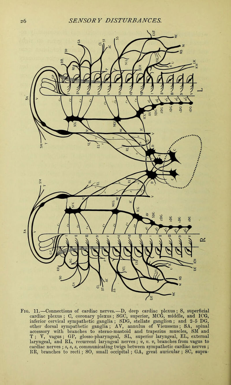 Fig. 11.—Connections of cardiac nerves.—D, deep cardiac plexus ; S, superficial cardiac plexus ; C, coronary plexus; SCO, superior, MCG, middle, and ICG, inferior cervical sympathetic ganglia ; SDG, stellate ganglion ; and 2-5 DG, other dorsal sympathetic ganglia; AV, annulus of Vieussens; SA, spinal accessory with branches to steriio-mastoid and trapezius muscles, SM and T ; V, vagus; GP, glosso-pharyngeal, SL, superior laryngeal, EL, external laryngeal, and RL, recurrent laryngeal nerves; v, v. v, branches from vagus to cardiac nerves ; s, s, s, communicating twigs between sympathetic cardiac nerves ; RR, branches to recti; SO, small occipital; GA, great auricular ; SC, supra-