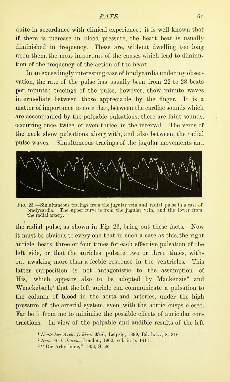 quite in accordance with clinical experience; it is well known that if there is increase in blood pressure, the heart beat is usually diminished in frequency. These are, without dwelling too long upon them, the most important of the causes which lead to diminu- tion of the frequency of the action of the heart. In an exceedingly interesting case of bradycardia under my obser- vation, the rate of the pulse has usually been from 22 to 28 beats per minute; tracings of the pulse, however, show minute waves intermediate between those appreciable by the finger. It is a matter of importance to note that, between the cardiac sounds which are accompanied by the palpable pulsations, there are faint sounds, occurring once, twice, or even thrice, in the interval. The veins of the neck show pulsations along with, and also between, the radial pulse waves. Simultaneous tracings of the jugular movements and Fig. 23.—Simultaneous tracings from the jugular vein and radial jmlse in a case of bradycardia. The uijper curve is from the jugular vein, and the lower from the radial artery. the radial pulse, as shown in Fig. 23, bring out these facts. Now it must be obvious to every one that in such a case as this, the right auricle beats three or four times for each effective pulsation of the left side, or that the auricles pulsate two or three times, with- out awaking more than a feeble response in the ventricles. This latter supposition is not antagonistic to the assumption of His,’^ which appears also to be adopted by Mackenzie^ and Wenckebach,^ that the left auricle can communicate a pulsation to the column of blood in the aorta and arteries, under the high pressure of the arterial system, even with the aortic cusps closed. Far be it from me to minimise the possible effects of auricular con- tractions. In view of the palpable and audible results of the left ^Deutsches Arch. f. klin. Med., Leipzig, 1899, Bd. Ixiv., S. 316. Brit. Med. Jbttra., London, 1902, vol. ii. p. 1411. ^ “ Die Arbytlimie,” 1903, S. 86.