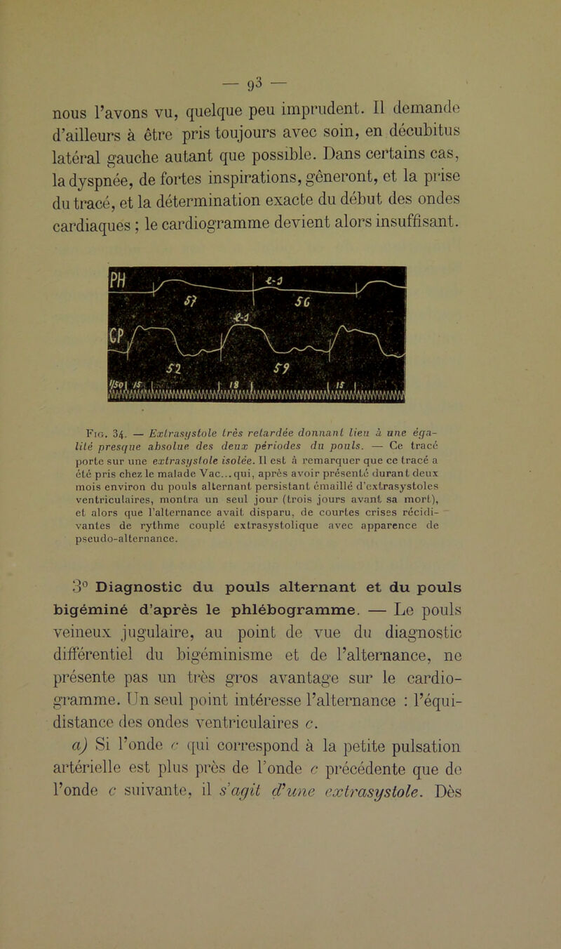 nous l’avons vu, quelque peu imprudent, il demande d’ailleurs à être pris toujours avec soin, en decubitus latéral gauche autant que possible. Dans certains cas, la dyspnée, de fortes inspirations, gêneront, et la prise du tracé, et la détermination exacte du début des ondes cardiaques ; le cardiogramme devient alors insuffisant. Fig. 34. — Exlrasystole très relardée donnant lien à une éga- lité presque absolue des deux périodes du pouls. — Ce tracé porte sur une exlrasystole isolée. Il est à remarquer que ce tracé a été pris chez le malade Vac... qui, après avoir présenté durant deux mois environ du pouls alternant persistant émaillé d'extrasystoles ventriculaires, montra un seul jour (trois jours avant sa mort), et alors que l’alternance avait disparu, de courtes crises récidi- vantes de rythme couplé extrasystolique avec apparence de pseudo-alternance. 3° Diagnostic du pouls alternant et du pouls bigéminé d’après le phlébogramme. — Le pouls veineux jugulaire, au point de vue du diagnostic différentiel du bigéminisme et de l’alternance, ne présente pas un très gros avantage sur le cardio- gramme. IJn seul point intéresse l’alternance : l’équi- distance des ondes ventriculaires c. ci) Si l’onde c qui correspond à la petite pulsation artérielle est plus près de bonde c précédente que de l’onde c suivante, il s agit d’une extrasystole. Dès