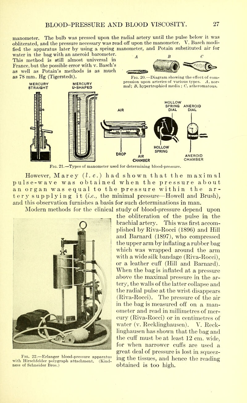 manometer. The bulb was pressed upon the radial artery until the pulse below it was obliterated, and the pressure necessary was read off upon the manometer. V. Baseh modi- fied the apparatus later by using a spring manometer, and Potain substituted air for water in the bag with an aneroid barometer. This method is still almost universal in France, but the possible error with v. Basch’s as well as Potain’s methods is as much as 78 mm. Hg (Tigerstedt). MERCURY MERCURY STRAIGHT U-SHAPED ABC Fig. 20.—Diagram showing the effect of com- pression upon arteries of various types. A, nor- mal ; B, hypertrophied media ; C, atheromatous. Fig. 21.—Types of manometer used for determining blood-pressure. However, Marey (I. c.) had shown that the maximal pulse -wave was obtained when the pressure about an organ was equal to the pressure within the ar- tery supplying it {i.e., the minimal pres.sure—Howell and Brush), and this observation furnishes a basis for such determinations in man. Alodern methods for the clinical study of blood-pressure depend upon the obliteration of the pulse in the brachial artery. This was first accom- plished by Riva-Rocci (1896) and Hill and Barnard (1897), who compressed the upper arm by inflating a rubber bag which was wrapped around the arm with a wide silk bandage (Riva-Rocci), or a leather cuff (Hill and Barnard). When the bag is inflated at a pressure above the maximal pressure in the ar- tery, the walls of the latter collapse and the radial pulse at the wrist disappears (Riva-Rocci). The pressure of the air in the bag is measured off on a man- ometer and read in millimetres of mer- cury (Riva-Rocci) or in centimetres of water (v. Recklinghausen). V. Reck- linghausen has showai that the bag and the cuff must be at least 12 cm. wide, for when narrower cuffs are used a great deal of pressure is lost in squeez- Fig. 22.—Erlanger blood-pres.?ure apparatus fUp tissilPR flnrl bpiipp fbp PAGrlbio- with Hirsclifelder polygraph attachment. (Kind- ^ ySSUeS, anu neilCe tlie reaCUllg ness of Schneider Bros.) obtained is too high.