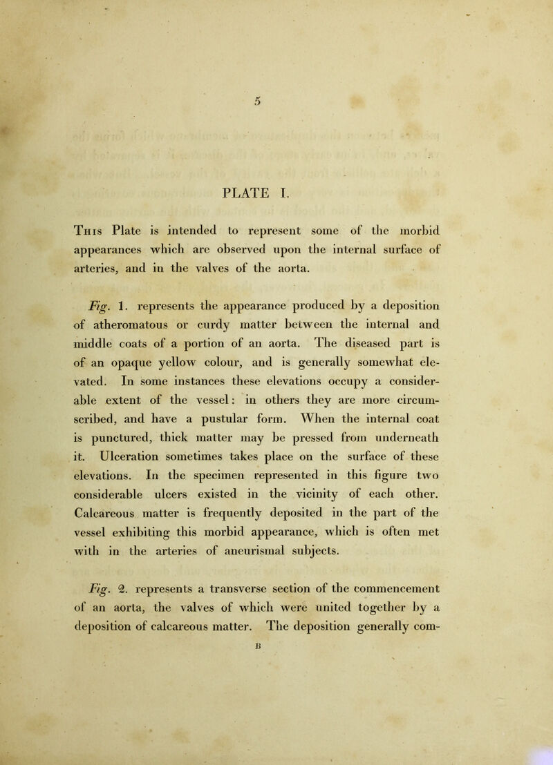 Th IS Plate is intended to represent some of the morbid appearances which are observed upon the internal surface of arteries, and in the valves of the aorta. Fig. 1. represents the appearance produced by a deposition of atheromatous or curdy matter between the internal and middle coats of a portion of an aorta. The diseased part is of an opaque yellow colour, and is generally somewhat ele- vated. In some instances these elevations occupy a consider- able extent of the vessel: in others they are more circum- scribed, and have a pustular form. When the internal coat is punctured, thick matter may be pressed from underneath it. Ulceration sometimes takes place on the surface of these elevations. In the specimen represented in this figure two considerable ulcers existed in the vicinity of each other. Calcareous matter is frequently deposited in the part of the vessel exhibiting this morbid appearance, which is often met with in the arteries of aneurisrnal subjects. Fig. 2. represents a transverse section of the commencement of an aorta, the valves of which were united together by a deposition of calcareous matter. The deposition generally com- B