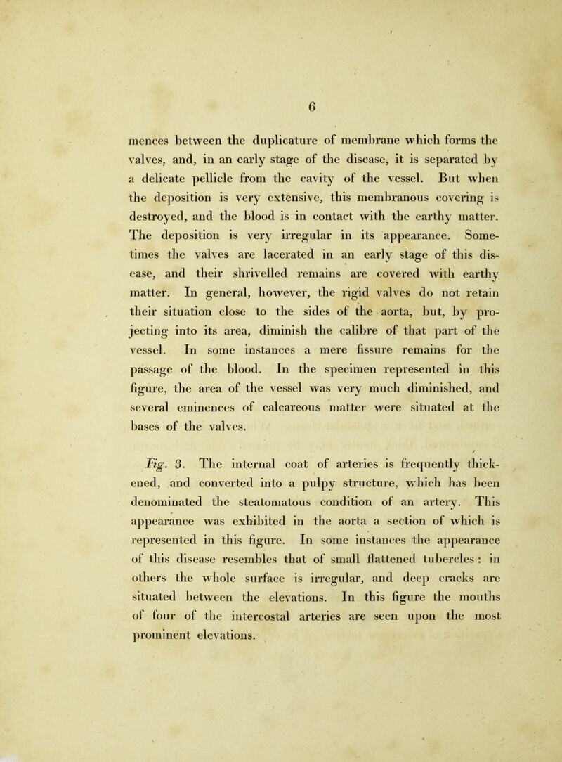 mences between the duplicature of membrane which forms the valveS; and, in an early stage of the disease, it is separated by a delicate pellicle from the cavity of the vessel. But when the deposition is very extensive, this membranous covering is destroyed, and the blood is in contact with the earthy matter. The deposition is very irregular in its appearance. Some- times the valves are lacerated in an early stage of this dis- ease, and their shrivelled remains are covered with earthy matter. In general, however, the rigid valves do not retain their situation close to the sides of the aorta, but, by pro- jecting into its area, diminish the calibre of that part of the vessel. In some instances a mere fissure remains for the passage of the blood. In the specimen represented in this figure, the area of the vessel was very much diminished, and several eminences of calcareous matter were situated at the bases of the valves. / Fig. 3. The internal coat of arteries is frequently thick- ened, and converted into a pulpy structure, which has been denominated the steatomatous condition of an artery. This appearance was exhibited in the aorta a section of which is represented in this figure. In some instances the appearance of this disease resembles that of small flattened tubercles : in others the whole surface is irregular, and deep cracks are situated between the elevations. In this figure the mouths of four of the intercostal arteries are seen upon the most prominent elevations.