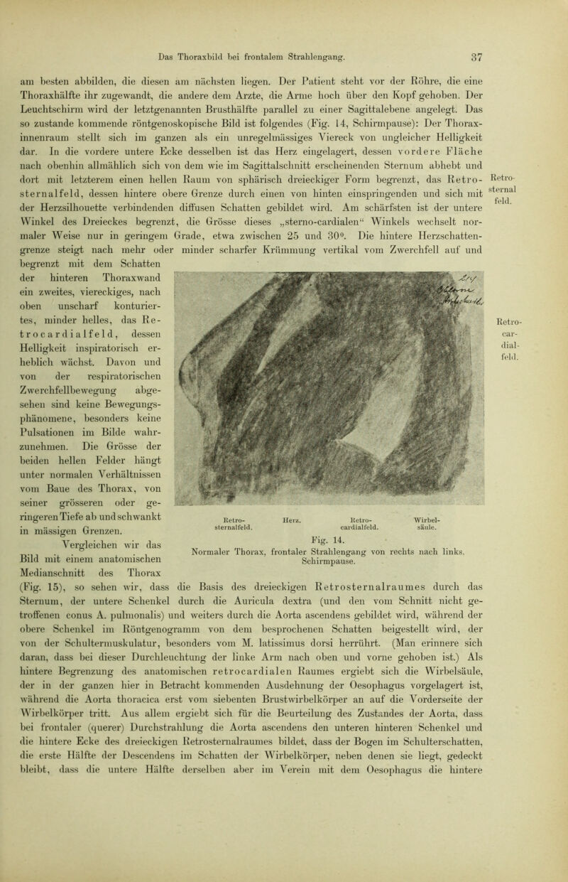 am besten abbilden, die diesen am nächsten liegen. Der i’atient steht vor der Röhre, die eine Thoraxhälfte ihr zugewandt, die andere dem Arzte, die Arme hoch über den Kopf gehoben. Der Leuchtschirm wird der letztgenannten Brusthälfte parallel zu einer Sagittalebene angelegt. Das so zustande kommende röntgenoskopische Bild ist folgendes (Fig. 14, Schirmpause): Der Thorax- innenraum stellt sich im ganzen als ein unregelmässiges Viereck von ungleicher Helligkeit dar. In die vordere untere Ecke desselben ist das Herz eingelagert, dessen vordere Fläche nach obenhin allmählich sich von dem wie im Sagittalschnitt erscheinenden Sternum abhebt und dort mit letzterem einen hellen Raum von sphärisch dreieckiger Form begrenzt, das Retro- sternalfeld, dessen hintere obere Grenze durch einen von hinten einspringenden und sich mit der Herzsilhouette verbindenden diffusen Schatten gebildet wird. Am schärfsten ist der untere Winkel des Dreieckes begrenzt, die Grösse dieses „sterno-cardialen“ Winkels wechselt nor- maler Weise nur in geringem Grade, etwa zwischen 25 und 30”. Die hintere Herzschatten- grenze steigt nach mehr oder minder scharfer Krümmung vertikal vom Zwerchfell auf und begrenzt mit dem Schatten der hinteren Thoraxwand ein zweites, viereckiges, nach oben unscharf konturier- tes, minder helles, das Re- t r o c a r (1 i a 1 f e 1 d, dessen Helligkeit inspii'atorisch er- heblich wächst. Davon und von der respiratorischen Zwerchfellbewegung abge- sehen sind keine Bewegungs- phänomene, besonders keine Pulsationen im Bilde wahr- zunehmen. Die Grösse der beiden hellen Felder hängt unter normalen A^erhältnissen vom Baue des Thorax, von seiner grösseren oder ge- ringeren Tiefe ab und schwankt in mässigen Grenzen. Vergleichen wir das Bild mit einem anatomischen Medianschnitt des Thorax (Fig. 15), so sehen wir, dass die Basis des dreieckigen Retrosternalraumes durch das Sternum, der untere Schenkel durch die Auricula dextra (und den vom Schnitt nicht ge- troffenen conus A. pulmonalis) und weiters durch die Aorta ascendens gebildet wird, während der obei’e Schenkel im Röntgenogramm von dem besprochenen Schatten beigestellt wird, der von der Schultermuskulatur, besonders vom M. latissimus dorsi herrührt. (Man erinnere sich daran, dass bei dieser Durchleuchtung der linke Arm nach oben und vorne gehoben ist.) Als hintere Begrenzung des anatomischen retrocardialen Raumes ergiebt sich die Wirbelsäule, der in der ganzen hier in Betracht kommenden Ausdehnung der Oesophagus vorgelagert ist, während die Aorta thoracica erst vom siebenten Brustwirbelköi'per an auf die Vorderseite der Wirbelkörper tritt. Aus allem ei'giebt sich für die Beurteilung des Zustandes der Aorta, dass bei frontaler (querer) Durchstrahlung die Aorta ascendens den unteren hinteren Schenkel und die hintere Ecke des dreieckigen Retrostemalraumes bildet, dass der Bogen im Schulterschatten, die erste Hälfte der Descendens im Schatten der Wirbelkörper, neben denen sie liegt, gedeckt bleibt, dass die untere Hälfte derselben aber im A^erein mit dem Oesophagus die hintere Ketro- Herz. Ketio- Wirbel- sternalfeld. cardialfeld. säule. Pig. 14. Normaler Thorax, frontaler Strahlengang von rechts nach links. Schirmpause. Retro- sternal fehl. Retro- car- (lial- feld.