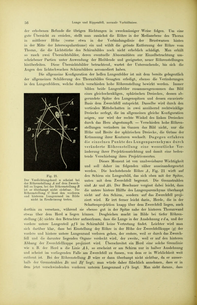 der erhobenen Befunde die übrigen Bichtungen in zweckmässiger Weise folgen. Um eine gute Übersicht zu erzielen, stellt man zunächst die Bohre in der Medianebene des Thorax in mittlerer Höhe (vorne etwa in der Verbindungslinie der Brustwarzen hinten in der Mitte der Interscapularräume) ein und wählt die grösste Entfernung der Böhre vom Thorax, die die Lichtstärke des Schirmbildes noch nicht erheblich schädigt. Man erhält so rasch zwei Übersichtsbilder, deren eventuelle Abnormitäten zur Einzelbetrachtung um- schriebener Partien unter Anwendung der Bleiblende und geeigneter, neuer Böhrenstellungen hinüberleiten. Diese Übersichtsbilder betrachtend, wartet der Untersuchende, bis sich die Augen den lichtschwachen Schirmbildern accomodiert haben. Die allgemeine Konfiguration der hellen Lungenfelder ist mit dem bei’eits gelegentlich der allgemeinen Schilderung des Thoraxbildes Gesagten erledigt, ebenso die Veränderungen in den Lungenfeldern, welche durch verschieden hohe Köhrenstellung bewirkt werden. Immer bilden beide Lungenfelder zusammengenommen das Bild eines gleichschenkligen, sphärischen Dreieckes, dessen ab- gerundete Spitze den Lungenspitzen und dessen excavierte Basis dem Zwerchfell entspricht. Dasselbe wird durch den verticalen Mittelschatten in zwei annähernd rechtwinklige Dreiecke zerlegt, die im allgemeinen gleiche Konfiguration zeigen, nur wird der rechte Winkel des linken Dreieckes durch das Herz abgestumpft. — Verschieden hohe Böhren- stellungen verändern im Ganzen das Bild nicht, nur die Höhe und Breite der sphärischen Dreiecke, die Grösse der Krümmung ihrer Konturen wechselt. Dagegen erfahren die einzelnen Punkte des Lungenparenchyms durch veränderte Röhrenstellung eine wesentliche Ver- änderung ihrer Projektionsrichtung und damit eine l)edeu- tende Verschiebung ihres Projektionsortes. Dieses Moment ist von unabweisbarer Wichtigkeit und soll daher im folgenden näher auseinandergesetzt werden. Die hochstehende Röhre .-1, Fig. 21 wirft auf den Schirm ein Lungenbild, das sich oben mit der Spitze, unten mit dem Zwerchfell begrenzt. Die Grenzstrahlen sind Ac und Ab. Der Beschauer vergisst dabei leicht, dass die untere hintere Hälfte des Lungenparenchyms überhauj)t nicht auf den Schirm, sondern auf das Zwerchfell proji- ziert Avird. Er irrt ferner leicht darin, Herde, die in der Schattenprojektion knapp über dem ZAverchfell liegen, auch dorthin zu versetzen, während sie ebenso gut in der Spitze nahe der hinteren Thoraxwand etwas über dem Herd n liegen können. Desgleichen macht im Bilde bei tiefer Röhren- Stellung (Z>) nichts den Betrachter aufmerksam, dass die Lunge in der Ausdehnung C(/a, und der vordere untere Lungenteil gfh im Schirmbild keine Vertretung findet. Leichter wird man sich darüber klar, dass bei Einstellung der Röhre in der Höhe der ZAverchfellkuppe {g) der vordere und hintere untere Lungenrand verloren gehen, der erstere, weil er durch das ZAverch- feil und die darunter liegenden Organe verdeckt wird, der zweite, Aveil er auf den hinteren Al)hang der ZAverchfellkuppe 2)rojiziert Avird. Überschreitet ein Herd eine solche Grenzlinie AAÜe z. B. der Herd n die Linie AZ/, so erscheint er am Schirm nur in halber Ausdehnung und scheint im vorliegenden Falle am ZAverchfell zu fussen, von dem er in Wirklichkeit Aveit entfernt ist. Bei der Röhrenstellung B Aväre er dann überhaupt nicht sichtbar, da er ausser- halb der Grenzstrahlen Bc und Bf liegt; man Avürde daher fälschlich annehmen, dass er in dem jetzt versclnvindenden vorderen unteren Lungenrand efh liegt. Man sieht daraus, dass Fig. 21. Der Verdichtungsherd n scheint bei der Köhrenstellung A auf dem Zwerch- fell zu liegen, bei der Röhrenstellung B ist er überhaupt nicht sichtbar. Die Köhrenstellung C lässt den vorderen und hinteren Lungenrand im Bilde nicht in Erscheinung treten.