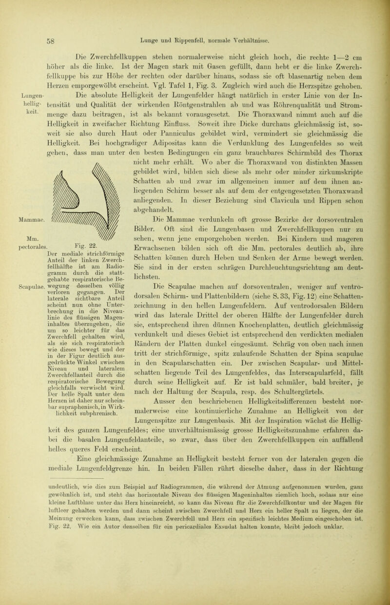 Die Zwerclifellkupi^en stehen normalerweise nicht gleich hoch, die rechte 1—2 cm höher als die linke. Ist der Magen stark mit Gasen gefüllt, dann hebt er die linke Zwerch- fellkuppe bis zur Höhe der rechten oder darüber hinaus, sodass sie oft blasenartig neben dem Herzen emporgewöD)t erscheint. Vgl. Tafel 1, Fig. 3. Zugleich wird auch die Herzspitze gehoben. Lungen- Die absolute Helligkeit der Lungenfelder hängt natürlich in erster Linie von der In- hellig- tensität und Qualität der wirkenden Röntgenstrahlen ab und was Rölmenqualität und Strom- menge dazu beitragen, i.st als bekannt vorausgesetzt. Die Thoraxwand nimmt auch auf die Helligkeit in zweifacher Richtung Einfluss. Soweit ihre Dicke durchaus gleichmässig ist, so- weit sie also durch Haut oder Panniculus gelhldet wird, vermindert sie gleichmässig die Helligkeit. Bei hochgradiger Adipositas kann die Verdunklung des Lungenfeldes so weit gehen, dass man unter den besten Bedingungen ein ganz brauchbares Schirmbild des Thorax nicht mehr erhält. Wo aber die ThoraxAvand von distinkten Massen gebildet Avird, bilden sich diese als mehr oder minder zirkumskrtpte Schatten ab und zAvar im allgemeinen immer auf dem ihnen an- liegenden Schirm besser als auf dem der entgengesetzten ThoraxAvand anliegenden. In dieser Beziehung sind Clavicula und Rippen schon abgehandelt. Die Mammae verdunkeln oft grosse Bezirke der dorsoventralen Bilder. Oft sind die Lungenbasen und ZAverchfellkuppen nur zu sehen, wenn jene emporgehoben Averden. Bei Kindern und mageren ErAvachsenen bilden sich oft die Mm. pectorales deutlich ab, ihre Schatten können durch Heben und Senken der Arme beAvesrt Averden. o Sie sind in der ersten schrägen Durchleuchtungsrichtung am deut- lichsten. Die Scapulae machen auf dorsoventralen, Aveniger auf ventro- dorsalen Schirm- und Plattenbildeni (siehe S. 33, Fig. 12) eine Schatten- zeichnung in den hellen Lungenfeldeni. Auf ventrodorsalen Bildern wird das laterale Drittel der oberen Hälfte der Lungenfelder durch sie, entsprechend ihren dünnen Knochenplatten, deutlich gleichmässig verdunkelt und dieses Gebiet ist entsprechend den verdickten medialen Rändern der Platten dunkel eingesäumt. Schräg von oben nach innen tritt der strichförmige, spitz zulaufende Schatten der Spina scapulae in den Scapularschatteu ein. Der zAvischen Scajjuhir- und Mittel- schatten liegende Teil des Lungenfeldes, das Interscapularfeld, fallt durch seine Helligkeit auf. Er ist bald schmäler, bald bi'eiter, je nach der Haltung der Scajiula, resp. des Schultergürdels. Ausser den beschriebenen Helligkeitsdifferenzen bestellt nor- malerweise eine kontinuierliche Zunahme an Helligkeit von der Lungenspitze zur Lungenbasis. Mit der Inspiration Avächst die Hellig- keit des ganzen Lungenfeldes; eine unverhältnismässig grosse Helligkeitszunahme erfahren da- bei die basalen Lungenfeldanteile, so ZAvar, dass über den ZAverchfellkup^ien ein auffallend helles queres Feld erscheint. Eine gleichmässige Zunahme an Helligkeit besteht ferner von der lateralen gegen die mediale Lungenfeldgrenze hin. In beiden Fällen rührt dieselbe daher, dass in dei’ Richtung Der mediale stricliförmige Anteil der linken ZAverch- fellliälfte ist am Radio- gramm durch die statt- gehabte respiratorische Be- Scapulae. wegung desselben völlig verloren gegangen. Der laterale sichtbare Anteil scheint nun ohne Unter- brechung in die Niveau- linie des flüssigen Magen- inhaltes überzugehen, die um so leichter für das Zwerchfell gehalten wird, als sie sich respiratorisch wie dieses bewegt und der in der Figur deutlich aus- gedrückte Winkel zwischen Niveau und lateralem Zwerchfellanteil durch die resj>iratorische Bewegung gleichfalls verwischt wird. Der hello Spalt unter dem Herzen ist daher nur schein- bar su])raphenisch, in Wirk- lichkeit subphrenisch. undeutlich, wie dies zum Beispiel auf Radiogrammen, die während der Atmung aufgenommen wurden, ganz gewöhnlich ist, und steht das horizontale Niveau des flüssigen Mageninhaltes ziemlich hoch, sodass nur eine kleine Luftblase unter das Herz hineinreicht, so kann das Niveau für die Zwerchfellkontur und der Magen für luftleer gehalten werden und dann scheint zwischen Zwerchfell und Herz ein heller Spalt zu liegen, der die Meinung erwecken kann, dass zwischen Zwerchfell und Herz ein spezifisch leichtes Medium eingeschoben ist, Fig. 22, Wie ein Autor denselben für ein peidcardiales Exsudat halten konnte, bleibt jedoch unklar,