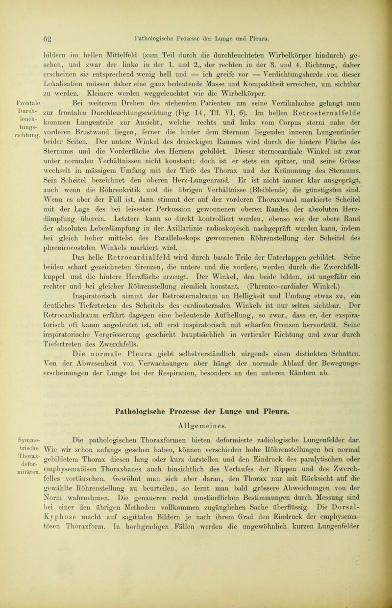 Frontale Liirch- leuch- tungs- richtung. Symme- trische Thorax- defor- mitilten. bildern im hellen Mittelfeld (zum Teil durch die durchleuchteten Wirbelkörper hindurch) ge- sehen, und zwar der linke in der 1, und 2., der rechten in der 3. und 4. Richtung, daher erscheinen sie entsprechend wenig hell und — ich greife vor — Yerdichtungsherde von dieser Lokalisation müssen daher eine ganz bedeutende Masse und Kompaktheit erreichen, um sichtbar zu Averden. Kleinere Averden AA^eggeleuchtet AAÜe die Wirbelkörper. Bei weiterem Drehen des stehenden Patienten um seine Vertikalachse gelangt man zur frontalen Durchleuchtungsrichtung (Fig. 14, Tfl. YI, 6). Im hellen Retrosternalfelde kommen Lungenteile zur Ansicht, AA^elche rechts und links vom Corpus sterni nahe der vorderen BrustAvand liegen, fenier die hinter dem Sternum liegenden inneren Lungenränder beider Seiten. Der untere Winkel des dreieckigen Raumes AAÜrd durch die hintere Fläche des Sternums und die Yorderfläche des Herzens gebildet. Dieser sternocardiale Winkel ist zAvar unter normalen Verhältnissen nicht konstant; doch ist er stets ein spitzer, und seine Grösse AA'echselt in mässigem Umfang mit der Tiefe des Thorax und der Krümmung des Sternums, Sein Scheitel bezeichnet den oberen Herz-Lungenrand. Er ist nicht immer klar ausgeprägt, auch AA'enn die Röhrenkritik und die übrigen Verhältnisse (Bleiblende) die günstigsten sind. Wenn es aber der Fall ist, dann stimmt der auf der vorderen ThoraxAA'and markierte Scheitel mit der Lage des bei leisester Perkussion geAvonnenen oberen Randes der absoluten Herz- dämjAfung überein. Letztei'e kann so direkt kontrolliert Averden, ebenso Avie der obere Rand der absoluten Leberdämpfung in der Axillarlinie radioskopisch nachgeprüft Averden kann, indem bei gleich hoher mittelst des Paralleloskops geAvonnenen Röhrenstellung der Scheitel des phrenicocostalen Winkels markiert Avird. Das helle Retrocardialfeld Avird durch basale Teile der Unterlappen gebildet. Seine Ijeiden schai’f gezeichneten Grenzen, die untere und die vordere, Averden durch die ZAverchfell- kuppel und die hintere Herzfläche erzeugt. Der Winkel, den beide bilden, ist ungefähr ein rechter und bei gleicher Röhrenstellung ziemlich konstant. (Phrenico-cardialer Winkel.) Inspiratorisch nimmt der Retrosternalraum an Helligkeit und Umfang etAvas zu, ein deutliches Tiefertreten des Scheitels des cardiosternalen Winkels ist nur selten sichtbar. Der Retrocardialraum erfährt dagegen eine bedeutende Aufhellung, so zwar, dass er, der exspira- torisch oft kaum angedeutet ist, oft erst inspiratorisch mit scharfen Grenzen hervortritt. Seine ins])iratorische Yergrösserung geschieht hauptsächlich in verticaler Richtung und ZAA^ar durch Tiefertreten des ZAverchfells. Die normale Pleura ffiebt selbstA^erständlich nirgends einen distinkten Schatten. Von der AbAvesenheit von VerAvachsungen aber hängt der normale Ablauf der BeAA^egungs- erscheinungen der Lunge bei der Respiration, besonders an den unteren Rändern ab. Pathologische Prozesse der Lunge und Pleura. Allgemeines. Die pathologischen Thoraxformen bieten deformierte radiologische Lungenfelder dar. Wie Avir schon anfangs gesehen haben, können verschieden hohe Röhi’enstellungen bei normal gebildetem Thorax diesen lang oder kurz darstellen und den Eindruck des paralytischen oder emphysematösen Thoraxbaues auch hinsichtlich des Verlaufes der Rippen und des ZAA'erch- felles Vortäuschen. GeAvöhnt man sich aber daran, den Thorax nur mit Rücksicht auf die gcAvählte Röhrenstellung zu beurteilen, so lernt man bald grössere AbAveichungen von der Norm Avahrnehmen. Die genaueren recht umständlichen Bestimmungen durch Messung sind bei einer den übrigen Methoden vollkommen zugänglichen Sache überflüssig. Die Dorsal- Kyphose macht auf sagittalen Bildern je nach ihrem Grad den Eindruck der emphysema- tösen Thoraxform, ln hochgradigen Fällen Averden die ungeAvöhnlich kurzen Lungenfelder