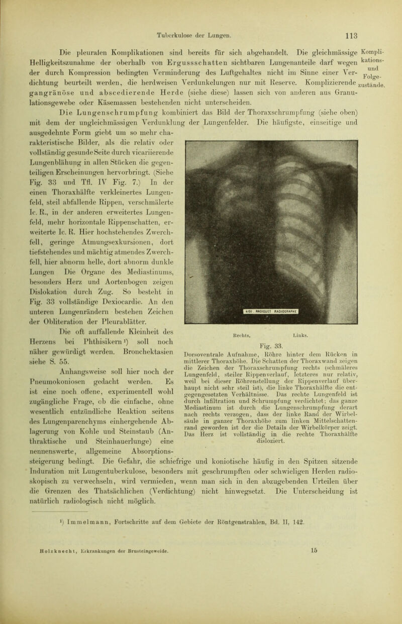 Die pleuralen Komplikationen sind bereits für sich abgehandelt. Die gleicbmässige Kompli- Helligkeitszunahnie der oberhalb von Ergussschatten sichtbaren Lungenanteile darf wegen kations- der durch Kompression bedingten Verminderung des Luftgehaltes nicht im Sinne einer Yer- dichtung beurteilt werden, die herdweisen Verdunkelungen nur mit Reserve. Komplizierende zustande gangränöse und abscedierende Herde (siehe diese) lassen sich von anderen aus Granu- lationsgewebe oder Käsemassen bestehenden nicht unterscheiden. Die Lu ngenschrumpfung kombiniert das Bild der Thoraxschrumpfung (siehe oben) mit dem der ungleichmässigen Verdunklung der Lungenfelder. Die häufigste, einseitige und ausgedehnte Form giebt um so mehr cha- rakteristische Bilder, als die relativ oder vollständig gesunde Seite durch vicariierende Lungenblähung in allen Stücken die j^egen- teiligen Erscheinungen hervorbringt. (Siehe Ifig. 33 und Tfl. IV Fig. 7.) In der einen Thoraxhälfte verkleinertes Lungen- feld, steil abfallende Rippen, verschmälerte Ic. R., in der anderen erweitertes Lungen- feld, mehr horizontale Rippenschatten, er- weiterte Ic. R. Hier hochstehendes Zwerch- fell, geringe Atmungsexkursionen, dort tiefstehendes und mächtig atmendes Zwerch- fell, hier abnorm helle, dort abnorm dunkle Lungen Die Organe des Mediastinums, besonders Herz und Aortenbogen zeigen Dislokation durch Zug. So besteht in Fig. 33 vollständige Dexiocardie. An den unteren Lungenrändern bestehen Zeichen der Obliteration der Pleurablätter. Die oft auffallende Kleinheit des Herzens bei Phthisikern G soll noch näher gewürdigt werden. Bronchekta.sien siehe S. 55. Anhangsweise soll hier noch der Pneumokoniosen gedacht werden. Es ist eine noch offene, experimentell wohl zugängliche Frage, ob die einfache, ohne wesentlich entzündliche Reaktion seitens des Lungenj)arenchyms einhergehende Ab- lagei’ung von Kohle und Steinstaub (An- thraktische und Steinhauerlunge) eine nennenswerte, allgemeine Absoqjtions- Kechts. Liuks. Fig. 33. Lor.soventrale Aufnabme, Röhre hinter dem Kücken in mittlerer Thoraxhöhe. Die Schatten der Thoraxwand zeigen die Zeichen der Thoraxschrumpfung rechts (schmäleres Lungenfeld, steiler Rippen verlauf, letzteres nur relativ, weil hei dieser Röhrenstellung der Rippenverlauf über- haupt nicht sehr steil ist), die linke Thoraxhälfte die ent- gegengesetzten Verhältnisse. Das rechte Lungenfeld ist durch Infiltration und Schrumpfung verdichtet; das ganze Mediastinum ist durch die Lungenschrumpfung derart nach rechts verzogen, dass der linke Rand der Wirbel- säule in ganzer Thoraxhöhe zum linken Mittelschatten- rand geworden ist der die Details der Wirbelkörper zeigt. Das Herz ist vollständig in die rechte Thoraxhälfte disloziert. Steigerung bedingt. Die Gefahr, die schiefrige und koniotische häufig in den Spitzen sitzende Induration mit Lungentuberkulose, besonders mit geschrumpften oder schwieligen Herden radio- skopisch zu verwechseln, wird vermieden, Avenn man sich in den abzugebenden Urteilen über die Grenzen des Thatsächlichen (Verdichtung) nicht hinAvegsetzt. Die Unterscheidung ist natürlich radiologisch nicht mölich. O O b Iramelmann, Fortschritte auf dem Gebiete der Röntgenstrahlen, Bd. II, 142. Holzkoecht, Kikrankuugen der Brusleingeweide. 15