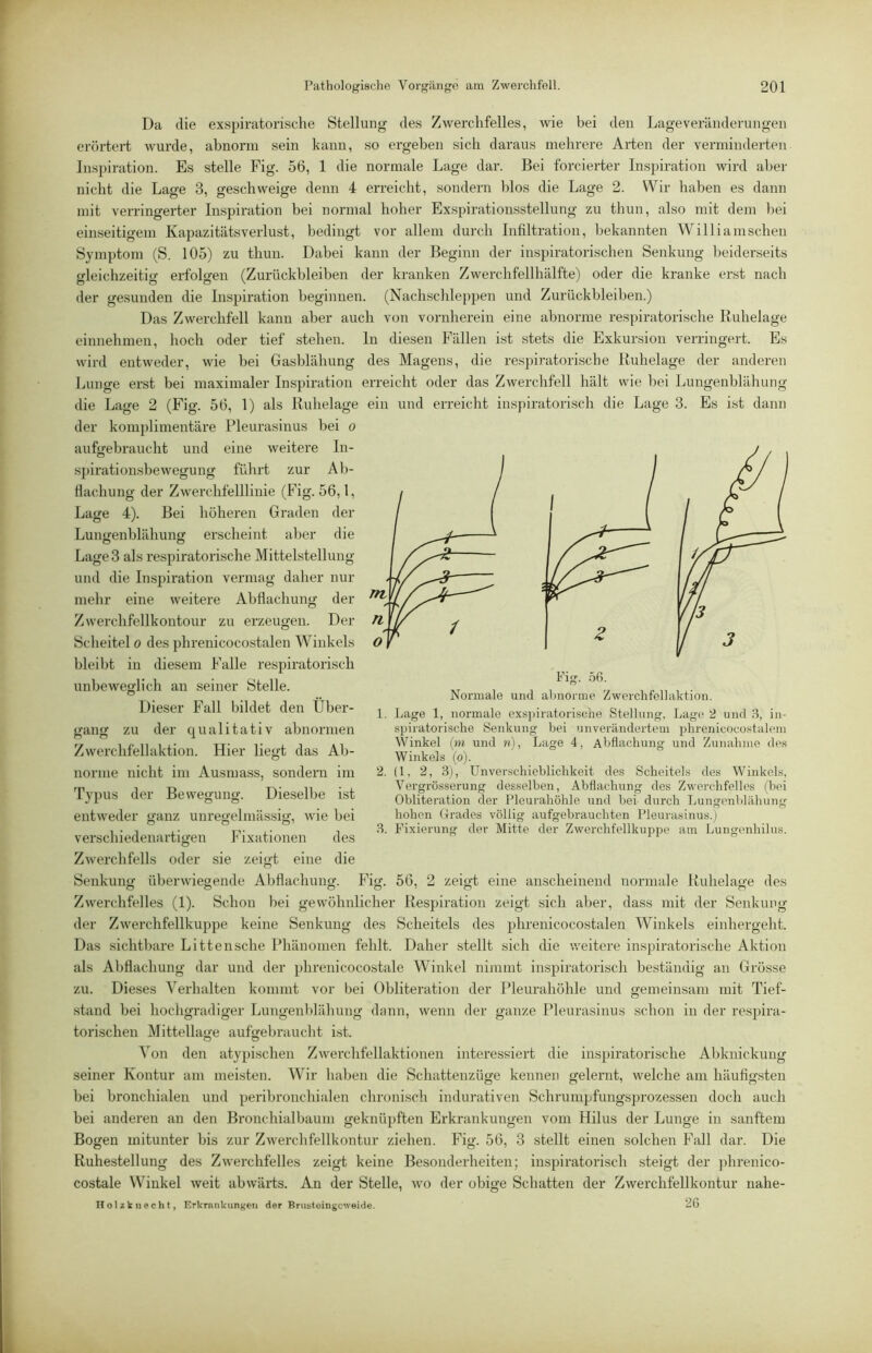 Da die exspiratorisclie Stellung des Zwerchfelles, wie bei den Lageveränderungen erörtert wurde, abnorm sein kann, so ergeben sich daraus mehrere Arten der vei’minderten Inspiration. Es stelle Fig. 56, 1 die normale Lage dar. Bei forcierter Inspiration wird aber nicht die Lage 3, geschweige denn 4 erreicht, sondern blos die Lage 2. Wir haben es dann mit verringerter Inspiration bei normal hoher Exspirationsstellung zu thun, also mit dem bei einseitigem Kapazitätsverlust, bedingt vor allem durch Infiltration, bekannten Williamscheii Symptom (S. 105) zu thun. Dabei kann der Beginn der inspiratorischen Senkung beiderseits gleichzeitig erfolgen (Zurückbleiben der kranken Zwercbfellhälfte) oder die kranke erst nach der gesunden die Inspiration beginnen. (Nachscbleppen und Zurückbleiben.) Das Zwerchfell kann aber auch von vornherein eine abnorme respiratorische Ruhelage einnebmen, hoch oder tief stehen. In diesen Fällen ist stets die Exkursion verringert. Es wird entweder, wie bei Gasbläbung des Magens, die respiratorische Ruhelage der anderen Lunge erst bei maximaler Inspiration erreicht oder das Zwerchfell hält wie bei Lungenblähung die Lage 2 (Fig. 56, 1) als Ruhelage ein und erreicht inspiratorisch die Lage 3. Es ist dann der komplimentäre Pleurasinus hei o aufgebraucht und eine weitere In- spirationshewegung führt zur Ab- flachung der Zwerchfelllinie (Fig. 56,1, Lage 4). Bei höheren Graden der Luimenblähunff erscheint aber die o O Lage 3 als respiratorische Mittelstellung und die Inspiration vermag daher nur mehr eine weitere Abflachung der Zwerchfellkontour zu erzeugen. Der Scheitel o des phrenicocostalen Winkels bleilit in diesem Falle respiratorisch unbeweglich an seiner Stelle. Dieser Fall bildet den Über- gang zu der ciualitativ abnormen Zwerchfellaktion. Hier liegt das Ab- norme nicht im Ausmass, sondern im Typus der Bewegung. Dieselbe ist entweder ganz unregelmässig, wie bei verschiedenartigen Fixationen des Zwerchfells oder sie zeigt eine die Senkung überwiegende Abflachung. Fig. 56, 2 zeigt eine anscheinend normale Ruhelage des Zwerchfelles (1). Schon bei gewöhnlicher Respiration zeigt sich aber, dass mit der Senkung der Zwerchfellkuppe keine Senkung des Scheitels des phrenicocostalen Winkels einhergeht. Das sichtbare Littensche Phänomen fehlt. Daher stellt sich die weitere inspiratorische Aktion als Abflachung dar und der phrenicocostale Winkel niiiimt inspiratorisch beständig an Grösse zu. Dieses Verhalten kommt vor bei Obliteration der Pleurahöhle und gemeinsam mit Tief- stand bei hochgradiger Lungenblähung dann, wenn der ganze Pleurasinus schon in der respira- torischen Mittelhme aufgebraucht ist. Von den atyjiischen Zwerchfellaktionen interessiert die inspiratorische Abknickung seiner Kontur am meisten. Wir haben die Schattenzüge kennen gelernt, welche am häufigsten bei bronchialen und peribronchialen chronisch indurativen Schrumpfungsprozessen doch auch bei anderen an den Bronchialbaum geknüpften Erkrankungen vom Hilus der Lunge in sanftem Bogen mitunter bis zur Zwerchfellkontur ziehen. Fig. 56, 3 stellt einen solchen Fall dar. Die Ruhestellung des Zwerchfelles zeigt keine Besonderheiten; inspiratorisch steigt der jdirenico- costale Winkel weit abwärts. An der Stelle, wo der obige Schatten der Zwerchfellkontur nahe- Hol*tiiecht, Erkriuikungen der Briistoingcweide. 26 Fig. .56. Normale und almorme Zwerchfellaktion. 1. Lage 1, normale exspiratorische Stellung, Lage 2 und 8, in- spiratorische Senkung bei unverändertem jihrenicocostalem Winkel {in und n), Lage 4, Abflachung und Zunahme des Winkels (o). 2. (1, 2, 3), Unverschieblichkeit des Scheitels des Winkels, Vergrösserung desselben, Abflachung des Zwerchfelles (bei Obliteration der Pleurahöhle und bei durch Lungenblähung hohen Orades völlig aufgebrauchten Pleurasinus.) 3. Fixierung der Mitte der Zwerchfellkuppe am Lungenhilus.