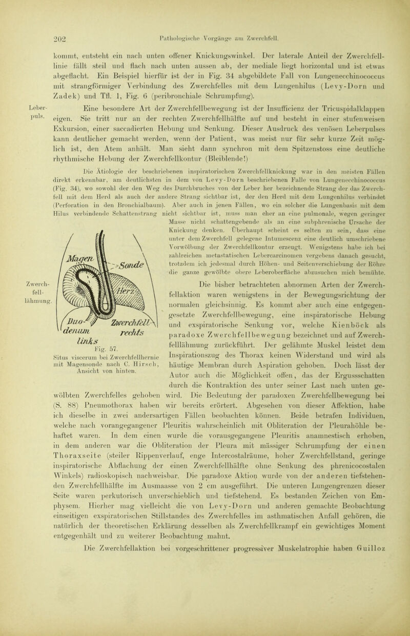 Leber- puls. Zwerch- fell- lilhmung koniint, entstellt ein nuch unten offener Knickun<r.swinkel. Der laterale Anteil der Zwercdifell- linie fällt steil und Hach nach unten aussen ab, der mediale liegt horizontal und ist etwas ahgeHacht. Ein Beisjiiel hierfür ist der in Fig. 34 abgebildete Fall von Lungenecchinococcus mit strangförniiger A'erhindung des Zwerchfelles mit dem Lungenhilus (Levy-l)orn und Zadek) und TH. 1, Fig. 6 (peribronchiale Schrumpfung). Eine besondere Art der Zwerchfellbewegung ist der Insufiicienz der Tricuspidalklappen eigen. Sie tritt nur an der rechten Zwerchfellhälfte auf und besteht in einer stufenweisen Exkursion, einer saccadierten Hebung und Senkung. Dieser Ausdruck des venösen Leherpulses kann deutlicher gemacht werden, wenn der Patient, was meist nur für sehr kurze Zeit mög- lich ist, den Atem anhält. Man sieht dann synchron mit dem Spitzenstoss eine deutliche rhythmische Hebung der Zwerchfellkontur (Bleiblende!) Die Ätiologie der beschriebenen insi)iratoriscli(“n Zwerchfellknickung war in den meisten Fällen direkt erkennbar, am deutlichsten in dem von Levy-Dorn beschriebenen Falle von Lungenecchinococcus (Fig. 84), wo sowohl der den Weg des Durchbruches von der Leber her bezeichnende Strang der das Zwerch- fell mit dem Herd als auch der andere Strang sichtbar ist, der den Herd mit dem Lungenhilus verbindet (Perforation in den Hronchialbaum). Aber auch in jenen Fällen, wo ein solcher die Lungenbasis mit dem Hilus verbindende Schattenstrang nicht sichtbar ist, muss man eher an eine pulmonale, wegen geringer Masse nicht schattengebende als an eine sub])hr(>nische Ui’sache der Knickung denken. Überhau])t scheint es selten zu sein, dass eim^ unter dem Zwerchfell gelegene Intumescenz eine deutlich um.schriel)ene Vorwölbung der Zwerchfellkontur erzeugt. Wenigstens habe ich bei zahlreichen metastatischen Lebercarcinomen vergeb(ms danach gesucht, trotzdem ich jedesmal durch Höhen- und Seitenverschiebung der Röhre die ganze gewölbte' obere Leberoberfläche abzusuchen mich bemühte. Die bisher betrachteten alniormen Arten der Zwerch- fellaktion waren wenigstens in der Beweguncfsrichtuno- der normalen gleichsinnig. Es kommt aber auch eine entgegen- gesetzte Zwerchfellbewegung, eine inspiratorische Hebung und exspiratorische Senkung vor, welche Kienböck als paradoxe Z w e r c h fe 11 b e w e g u n g bezeichnet und auf Z werch- felllähmung zurückführt. Der gelähmte Muskel leistet dem Inspirationszug des Thorax keinen Widerstand und wird als häutige Membran durch Aspiration gehoben. Doch lässt der Autor auch die Möglichkeit oHen, das der Ergussschatten durch die Kontraktion des unter seiner Last nach unten ge- wölbten Zwerchfelles gehoben wird. Die Bedeutung der })aradoxen Zwerchfellbewegung bei (S. 88) Pneumothorax haben wir bereits erörtert. Abgesehen von dieser Affektion, habe ich dieselbe in zwei andersartigen Fällen beol)achten können. Beide betrafen Individuen, welche nach vorangegangener Pleuritis wahrscheinlich mit Übliteration der Pleurahöhle be- haftet waren. In dem einen wurde die vorausgegangene Pleuritis anamnestisch erhoben, in dem anderen war die Obliteration der Pleura mit mässiger Schrumpfung der einen Thoraxseite (steiler Bij)penverlauf, enge Intercostalräume, hoher Zwerchfellstand, geringe inspiratorische AbHachung der einen Zwerchfellhälfte ohne Senkung des phrenicocostalen Winkels) radioskopisch nachweisbar. Die paradoxe Aktion wurde von der anderen tiefstehen- den Zwerchfellhälfte im Ausmaasse von 2 cm ausgeführt. Die unteren Luno-engrenzen dieser o o o Seite waren perkutorisch unverschieblich und tiefstehend. Es bestanden Zeichen von Em- physem. Hierher mag vielleicht die von Lev^'-Dorn und anderen gemachte Beobachtung einseitigen exs])iratorischen Stillstandes des Zwerchfelles im asthmatischen Anfall gehören, die natürlich der theoretischen Erklärung desselben als Zwerchfellkrampf ein gewichtiges Moment entgegenhält und zu weiterer Beobachtung mahnt. Die Zwerchfellaktion bei vorgeschrittener progressiver Muskelatrophie haben Guilloz ZwerchfdV- ^^denum rechts links Fig. 57. 8ifus viscenim bei Zwerclifellliernie mit Magensomle nach C. Hirsch, Ansicht von hinten.