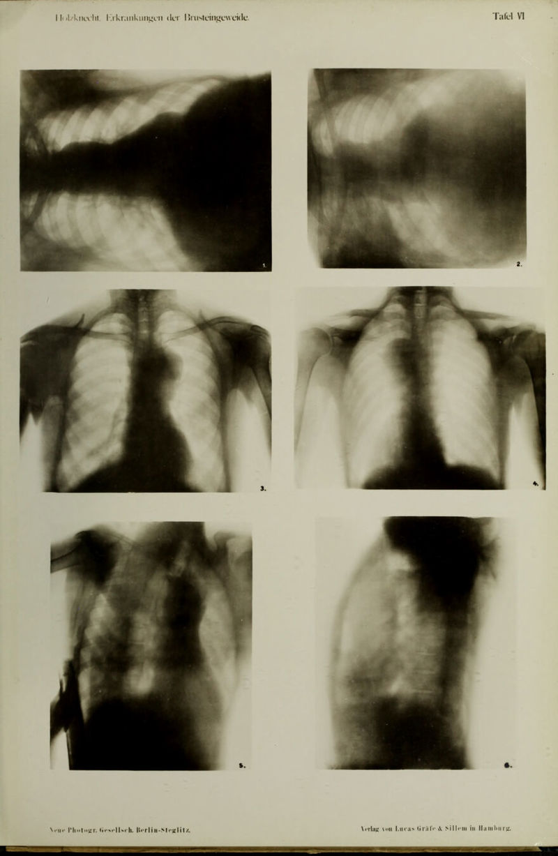 \>'i'liiu Voll (irrih' \ in Ihiinl<iir;;.