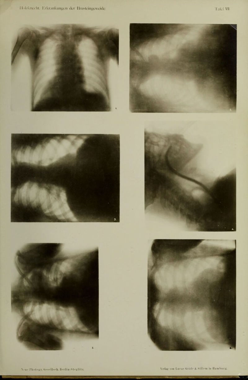 \i iir l’licitii r. lli'i'liii-Mi'irlh/.. \iTlau; \>>ii l.iicas liiälV \ Silli'iii in llaiiiliiirjr.